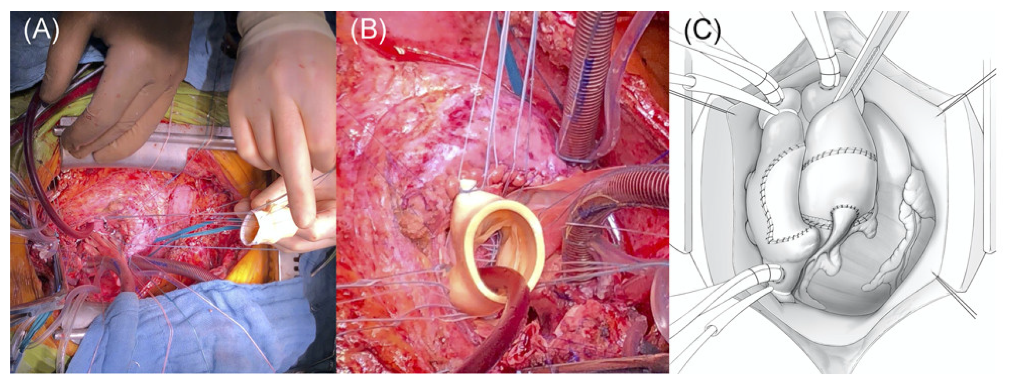 Diagnostics 14 00464 g003 Diagnostics 14 00464 g003