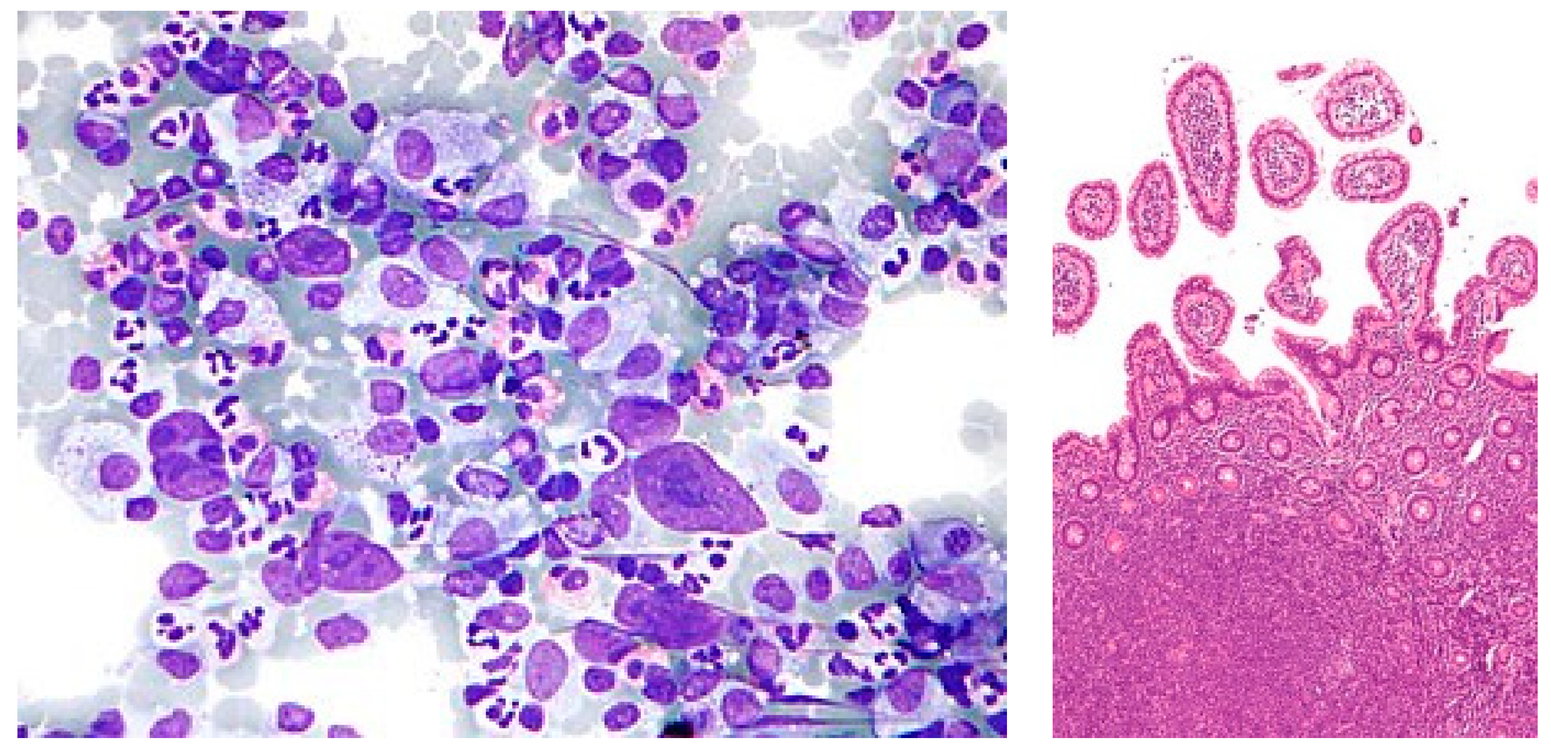 Diagnostics 14 00469 g001