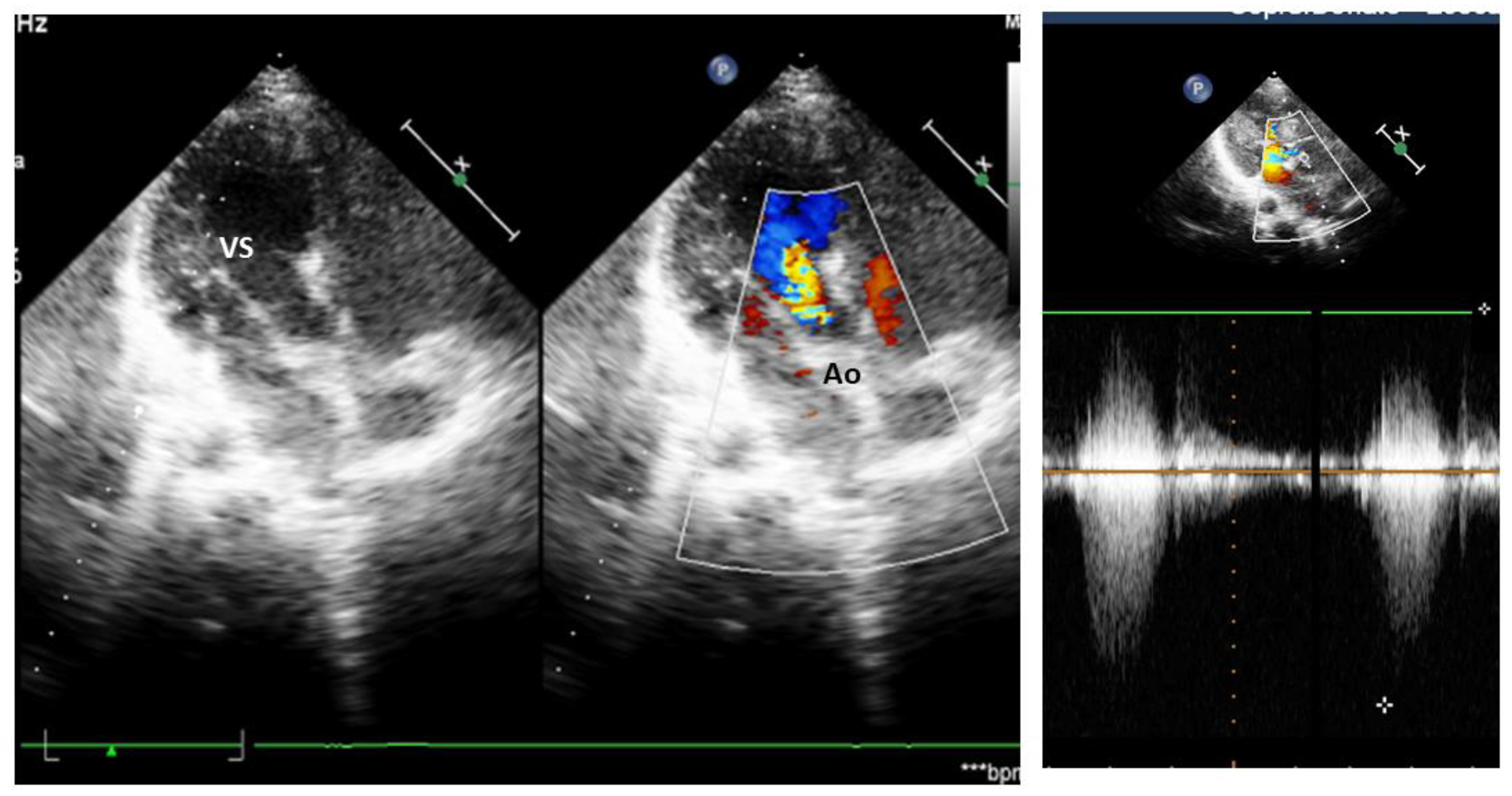 Diagnostics 14 00470 g003