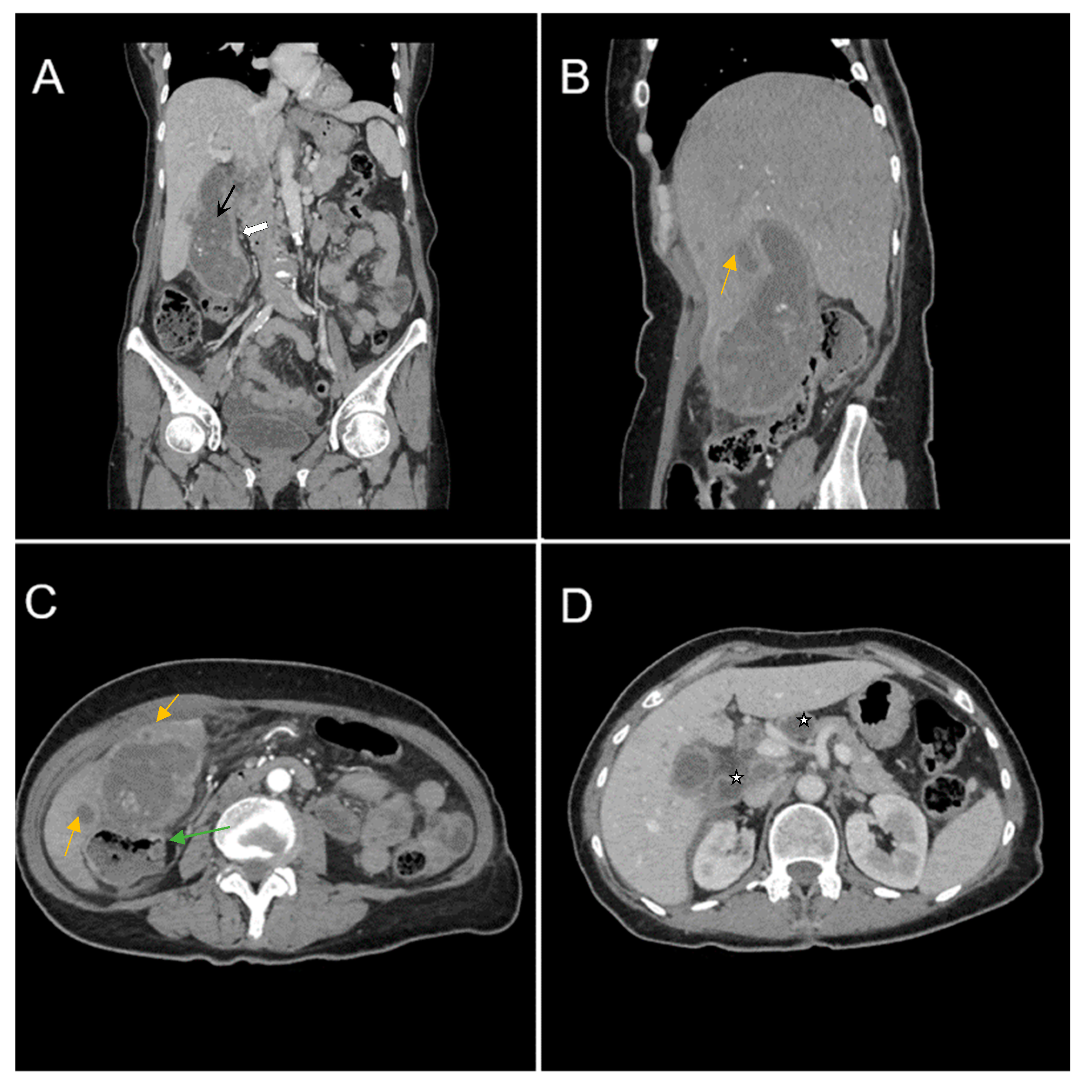 Diagnostics 14 00475 g001