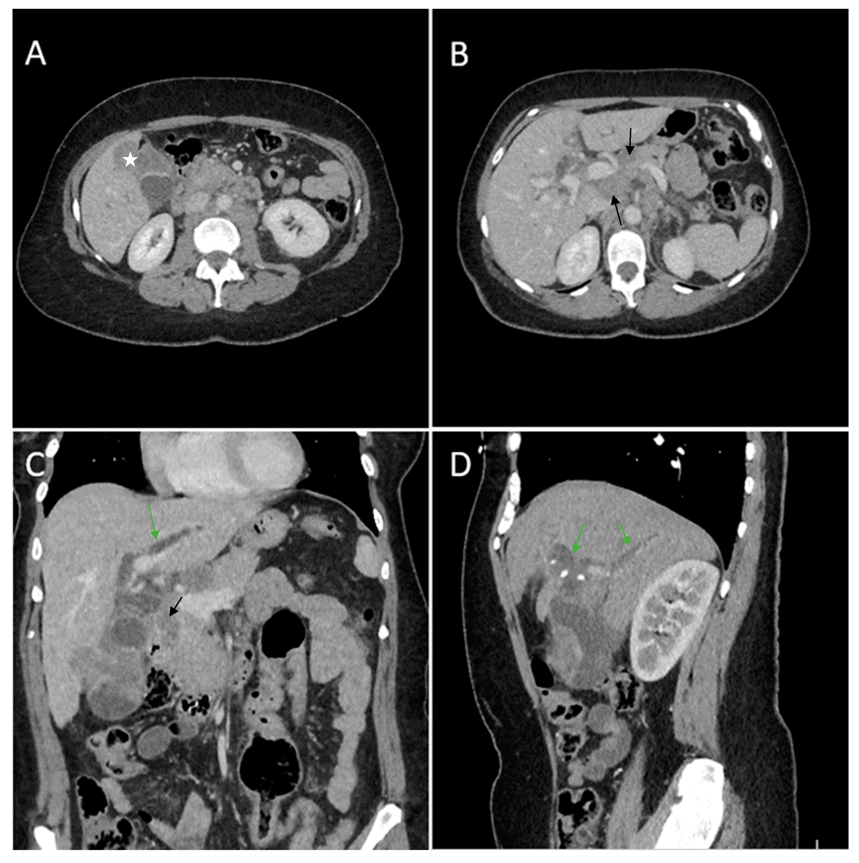 Diagnostics 14 00475 g004