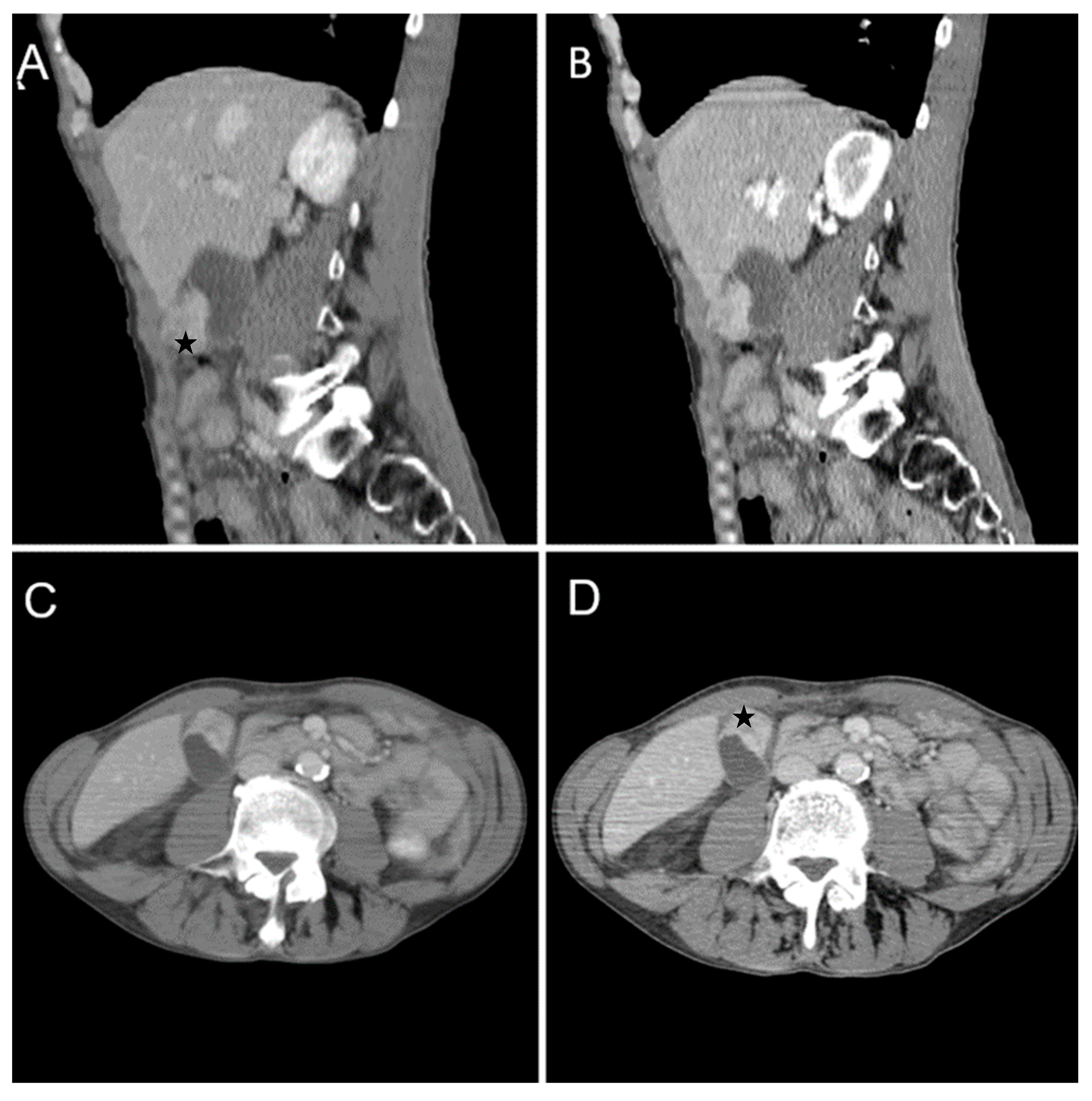 Diagnostics 14 00475 g007