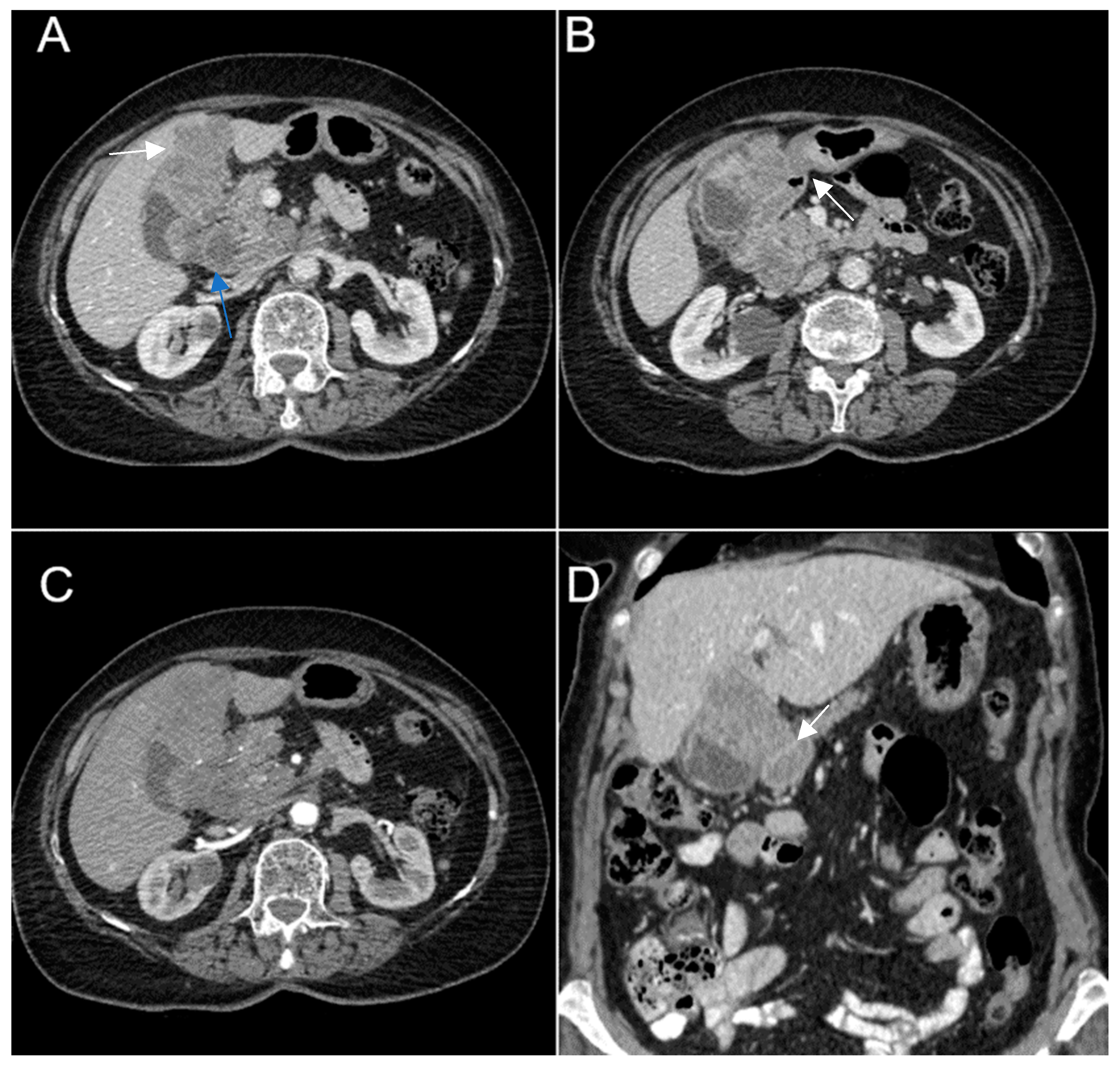 Diagnostics 14 00475 g009