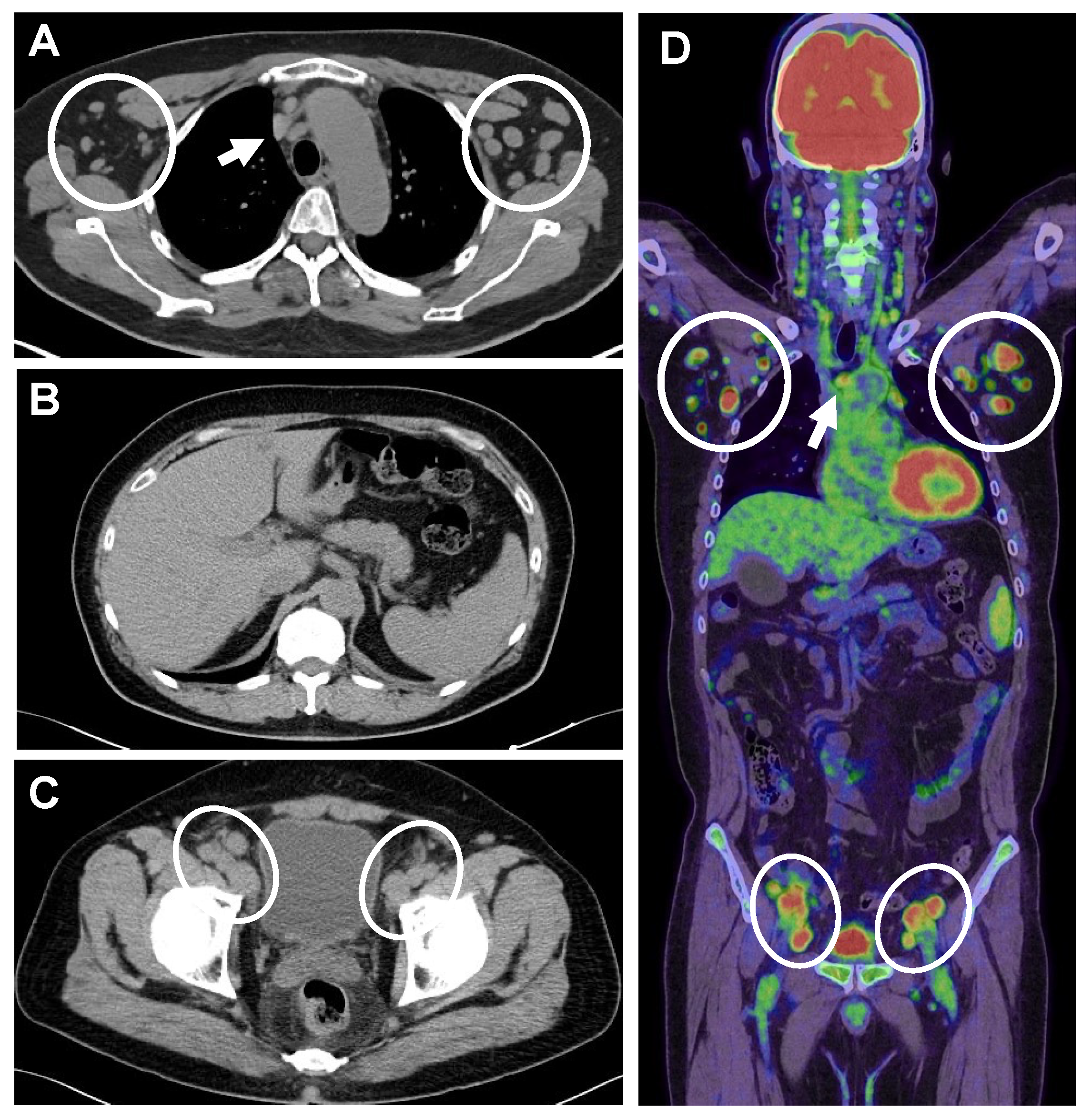 Diagnostics 14 00476 g001 Diagnostics 14 00476 g001