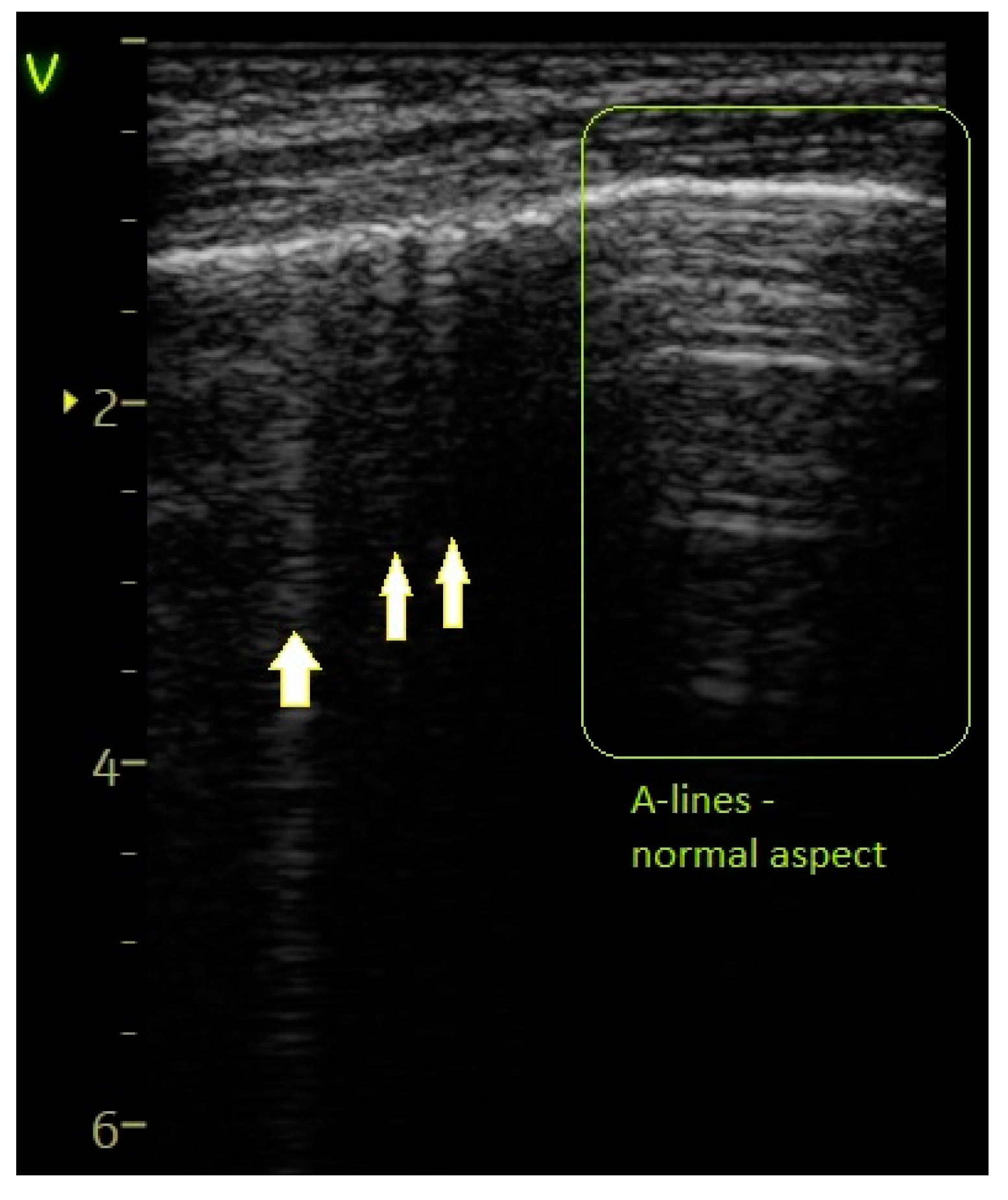 Diagnostics 14 00480 g003