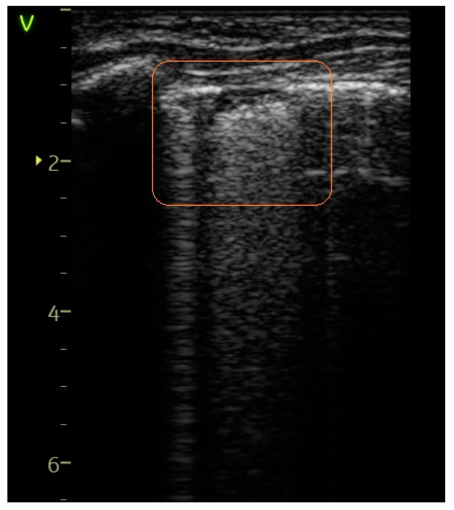 Diagnostics 14 00480 g004