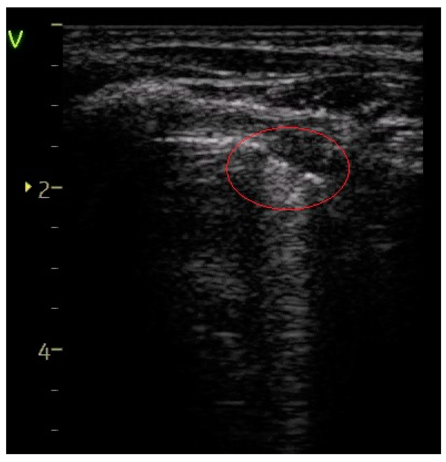Diagnostics 14 00480 g005