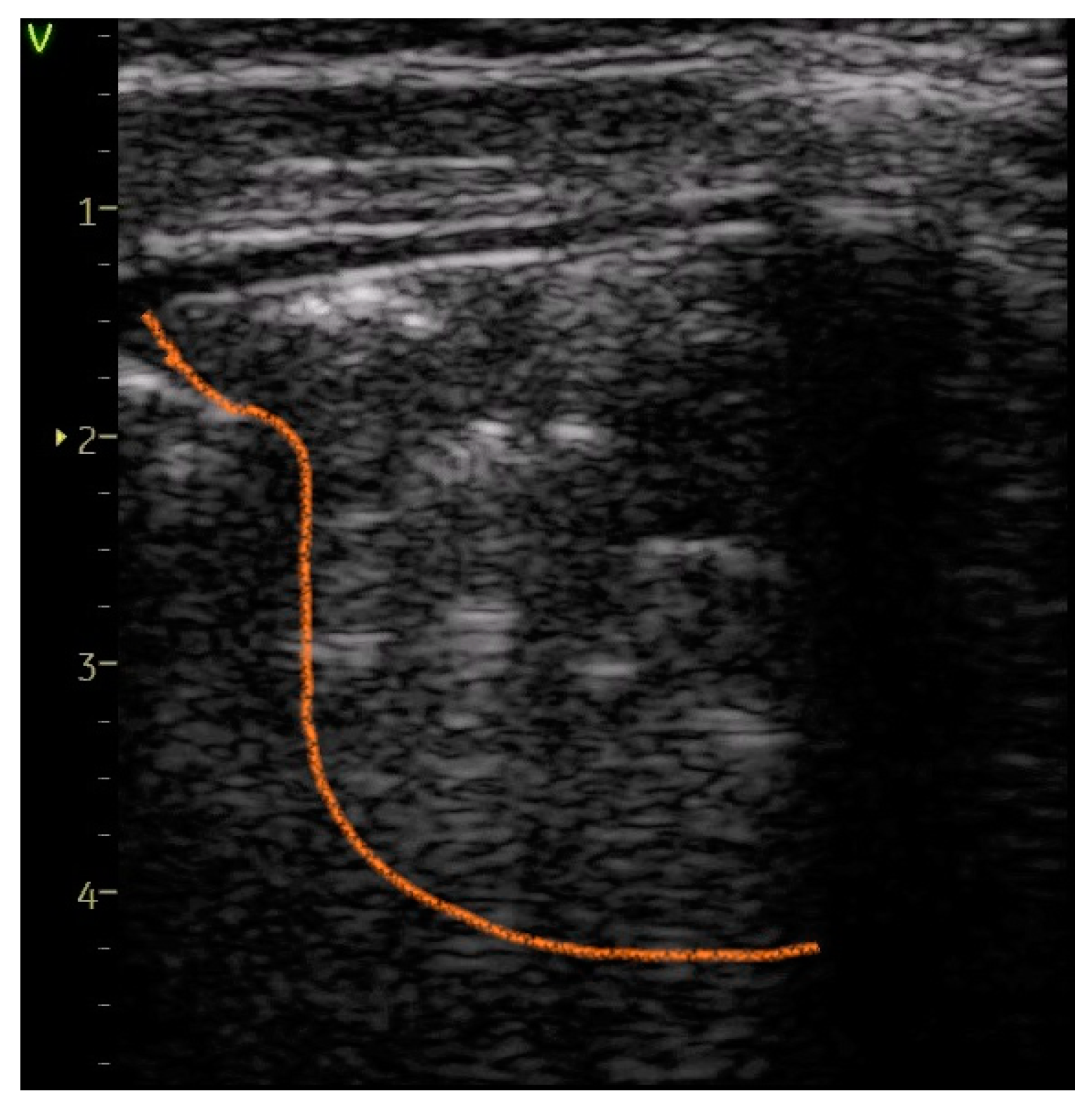 Diagnostics 14 00480 g007