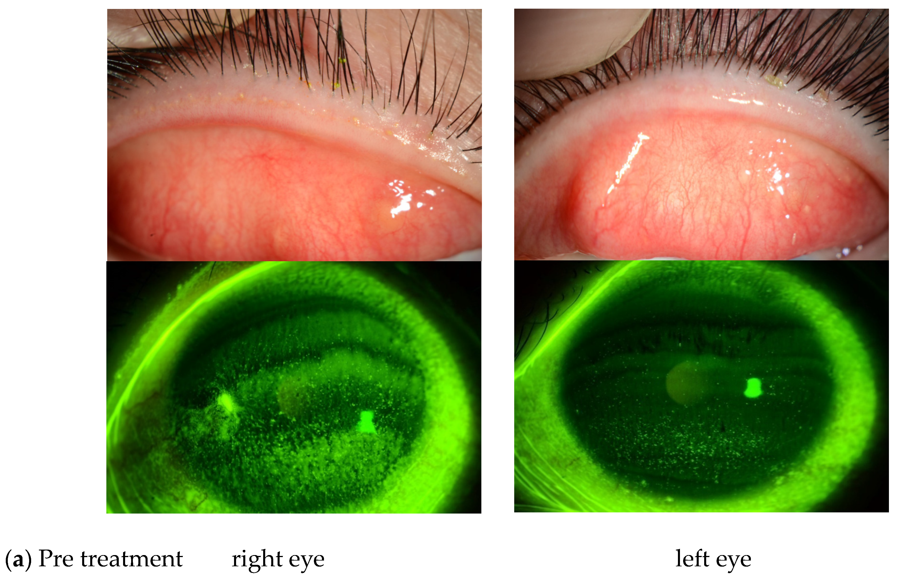 Diagnostics 14 00487 g001a