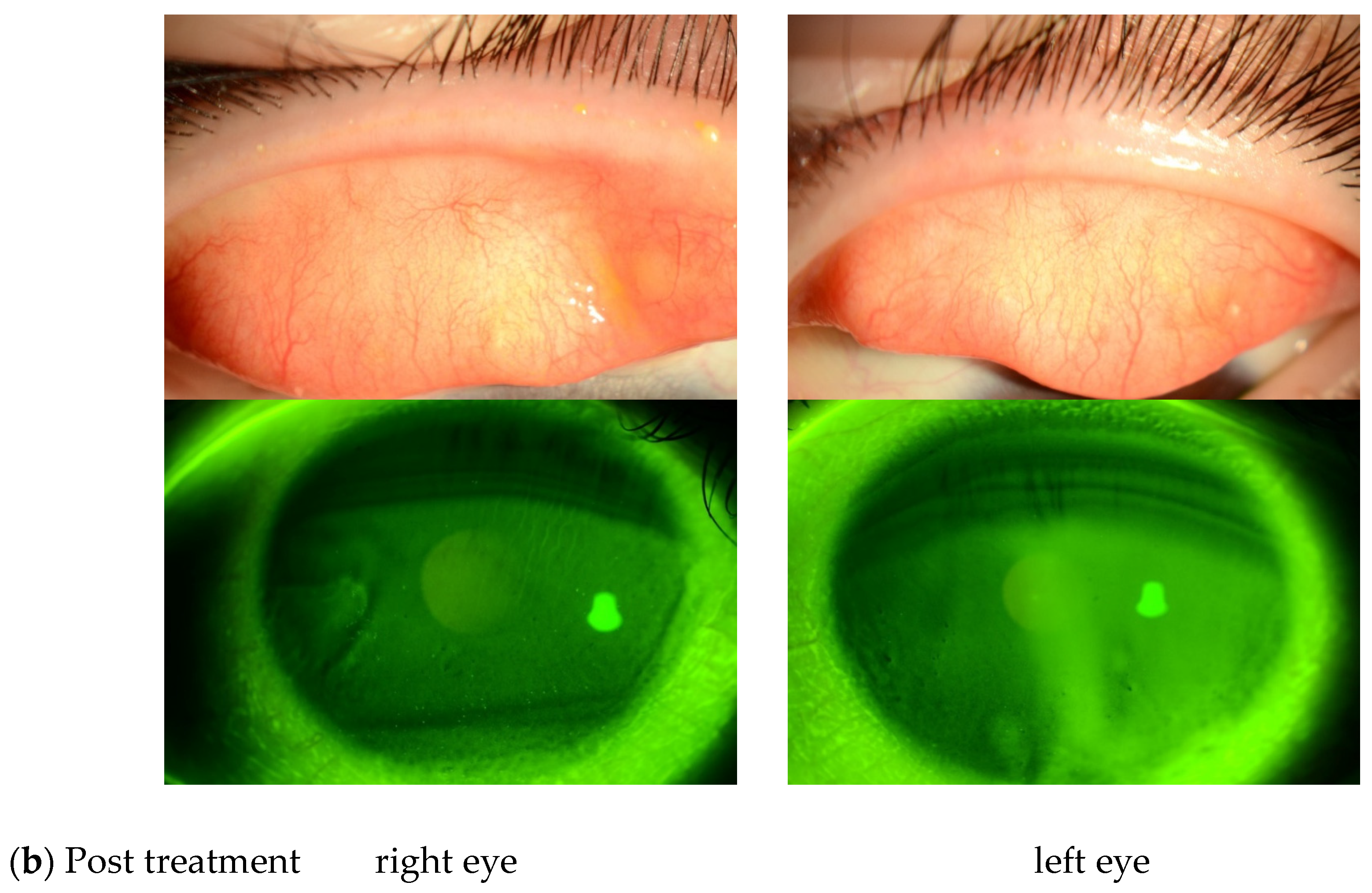 Diagnostics 14 00487 g001b