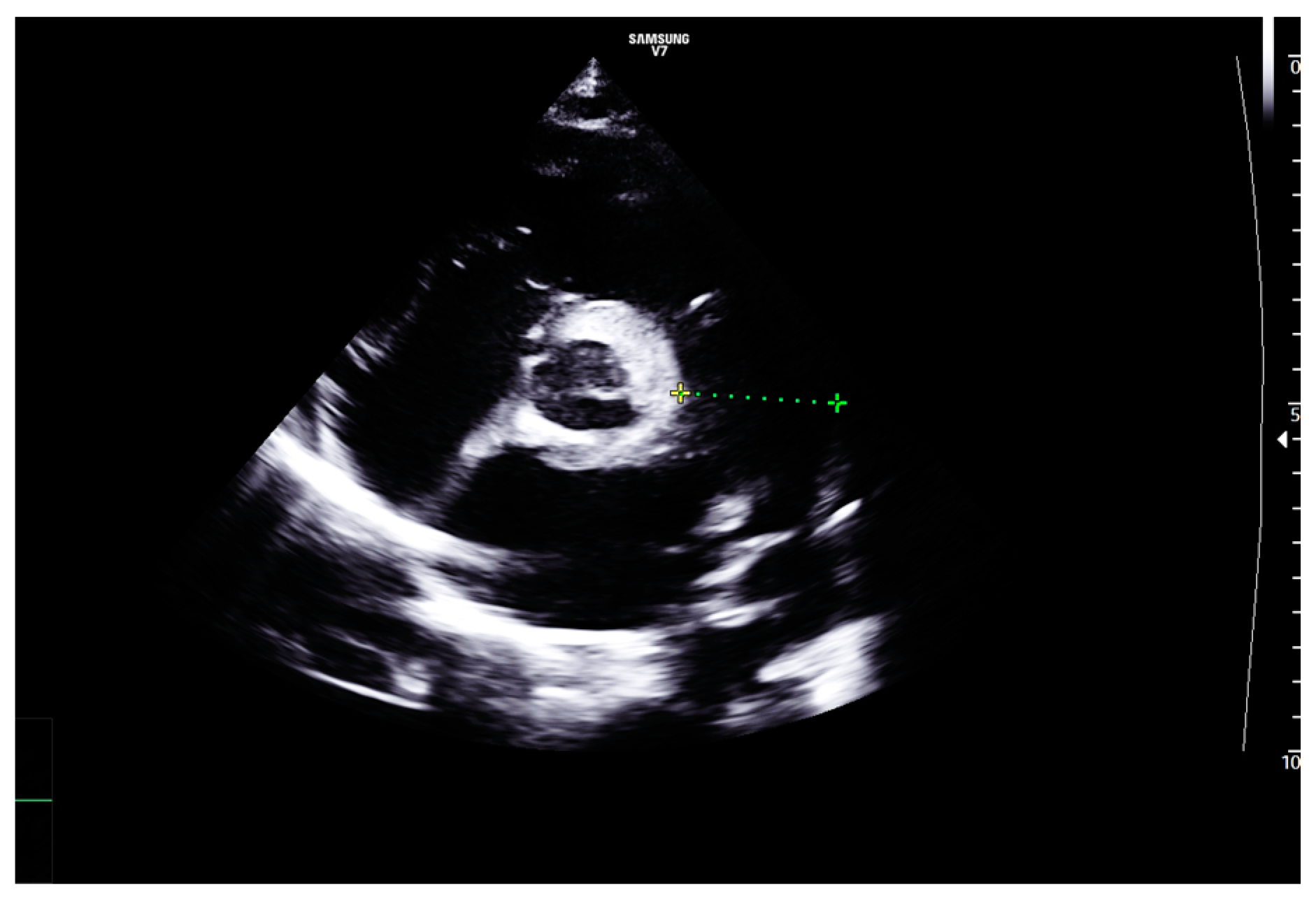 Diagnostics 14 00491 g002