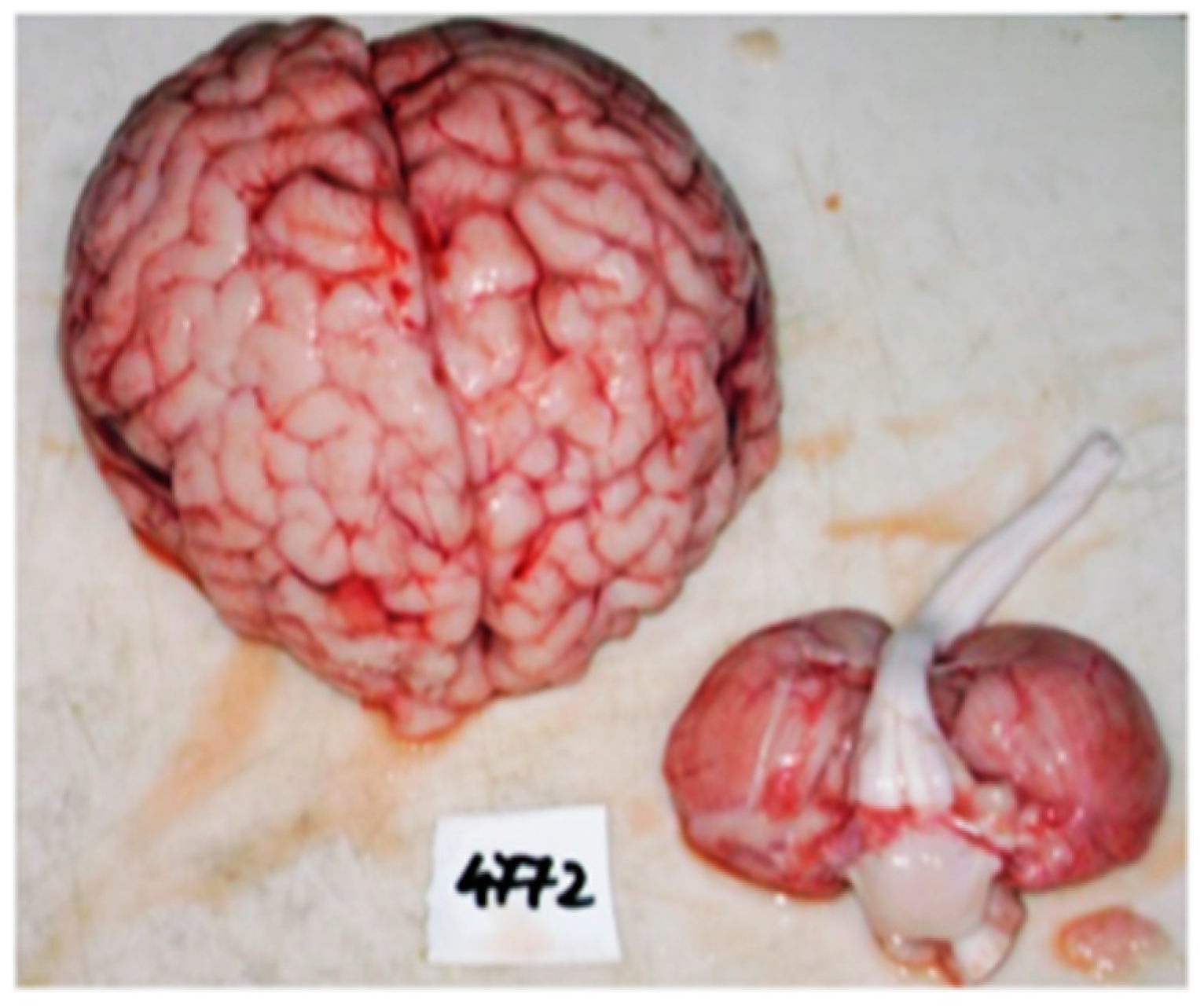 Diagnostics 14 00491 g004