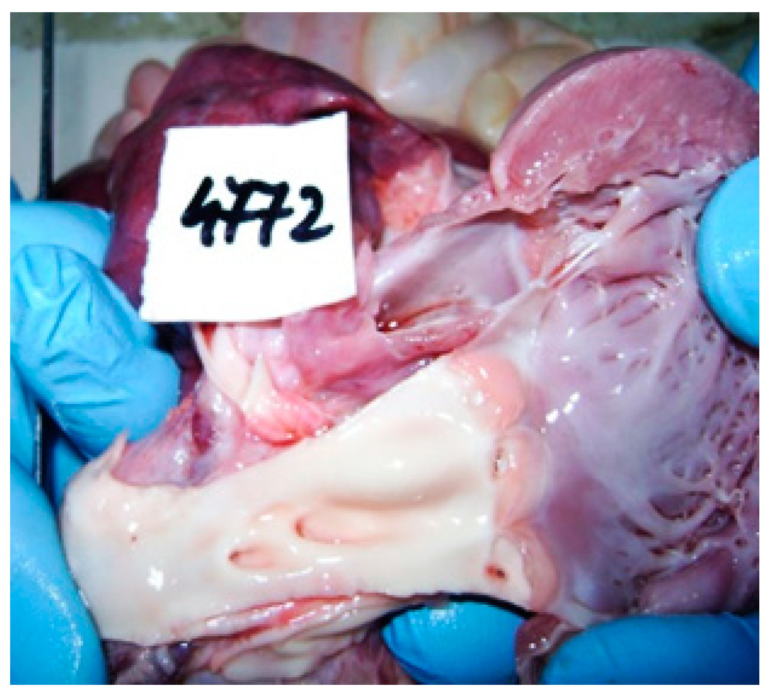 Diagnostics 14 00491 g005