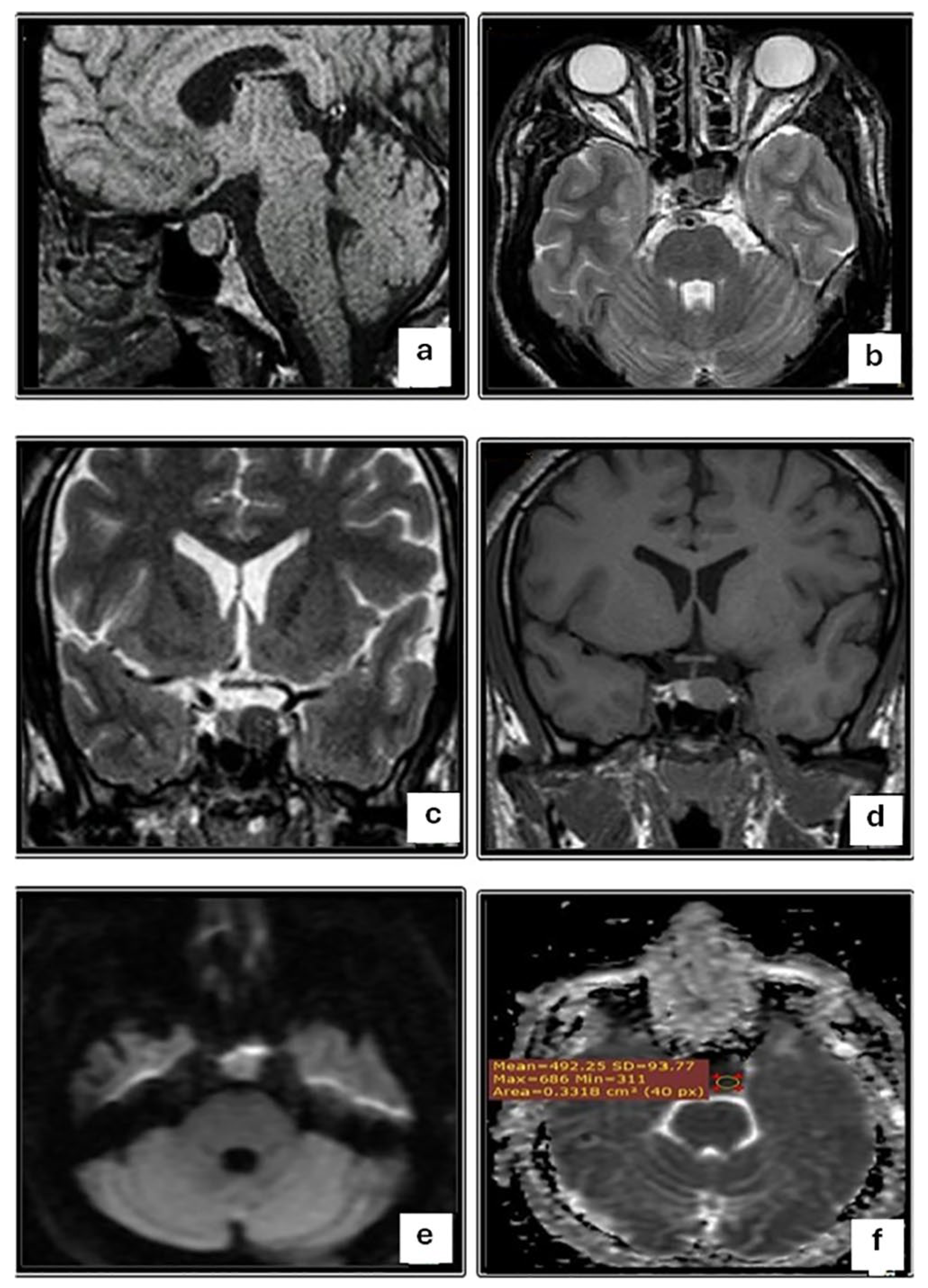 Diagnostics 14 00493 g001 Diagnostics 14 00493 g001