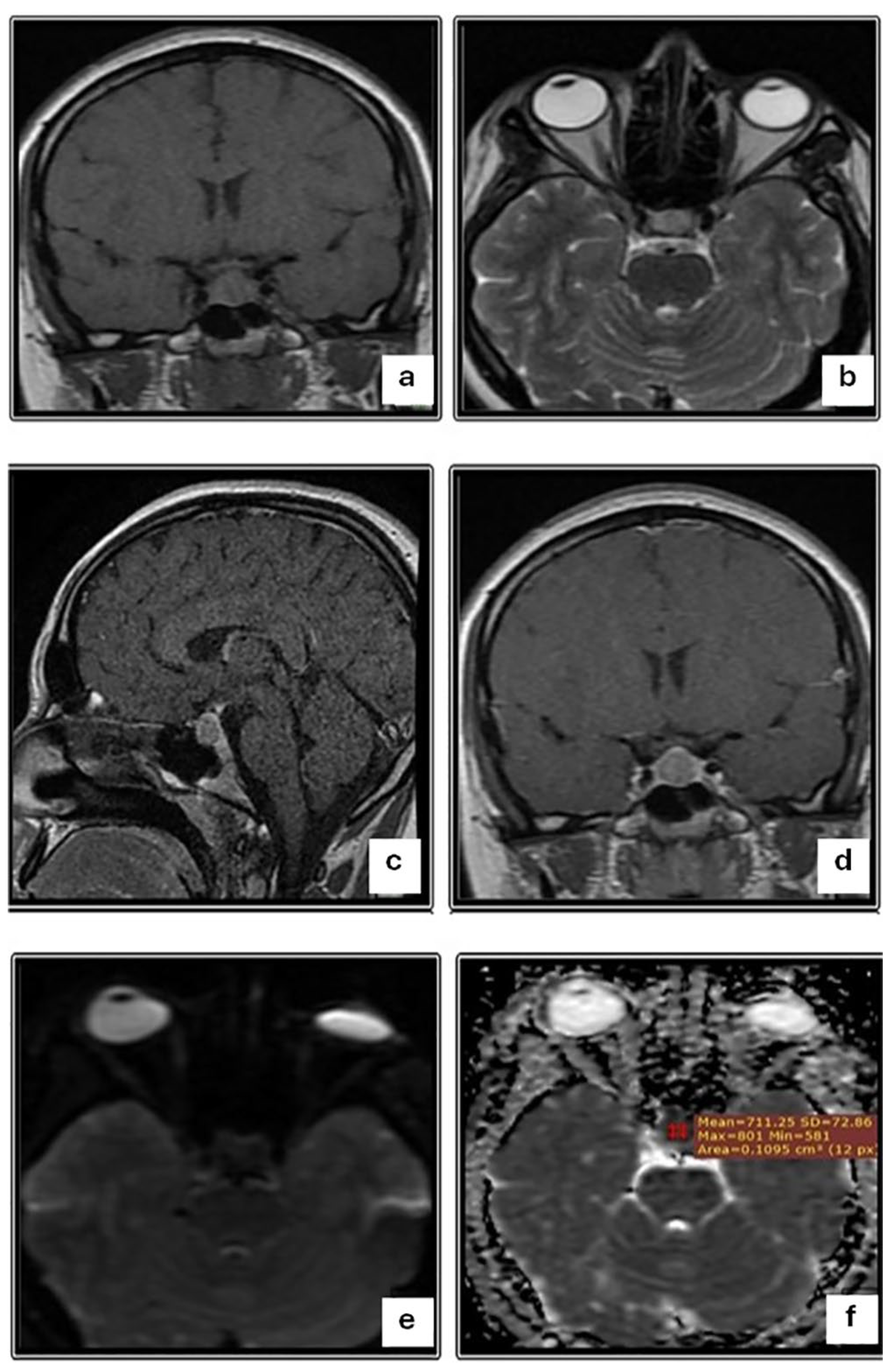 Diagnostics 14 00493 g002 Diagnostics 14 00493 g002