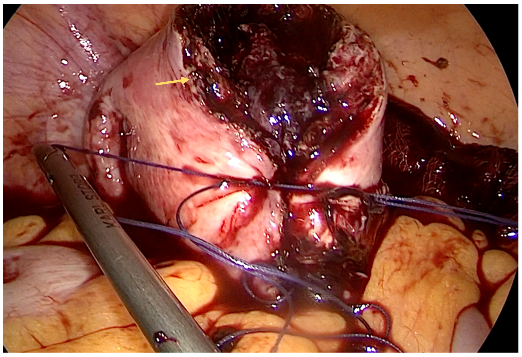 Diagnostics 14 00506 g003 Diagnostics 14 00506 g003