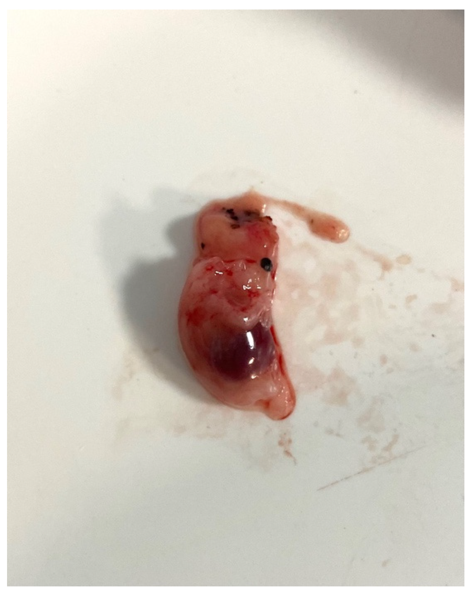 Diagnostics 14 00506 g005 Diagnostics 14 00506 g005