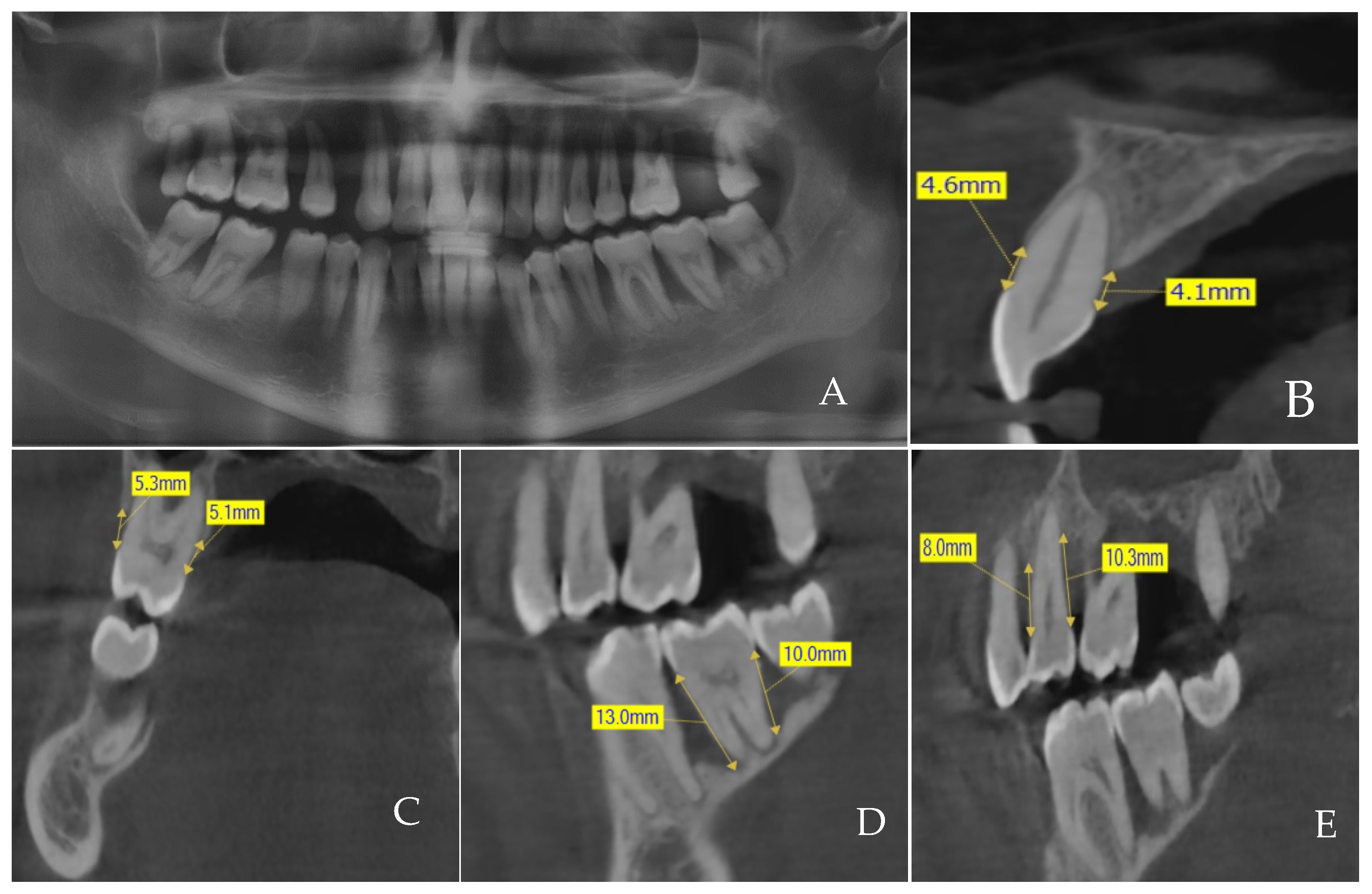 Diagnostics 14 00507 g003