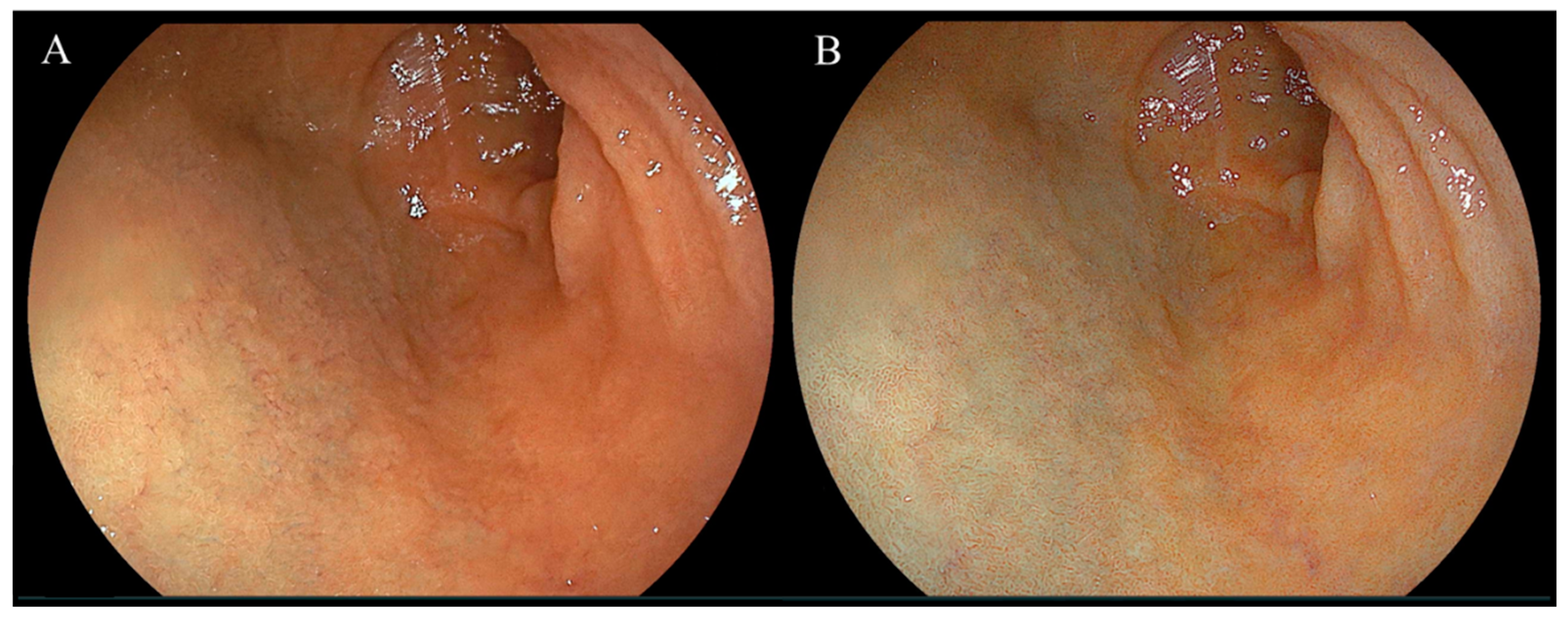 Diagnostics 14 00508 g003