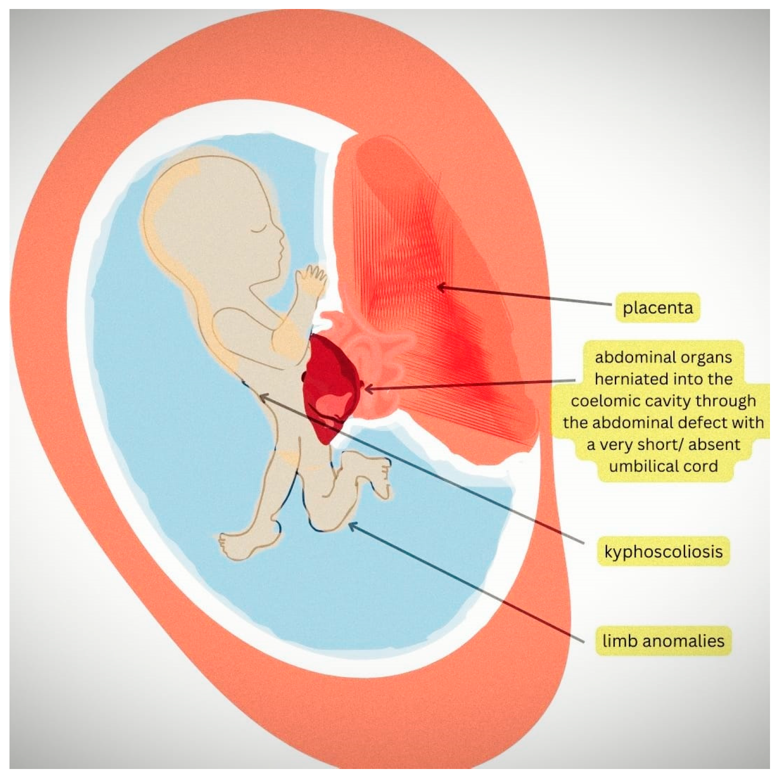 Diagnostics 14 00518 g001