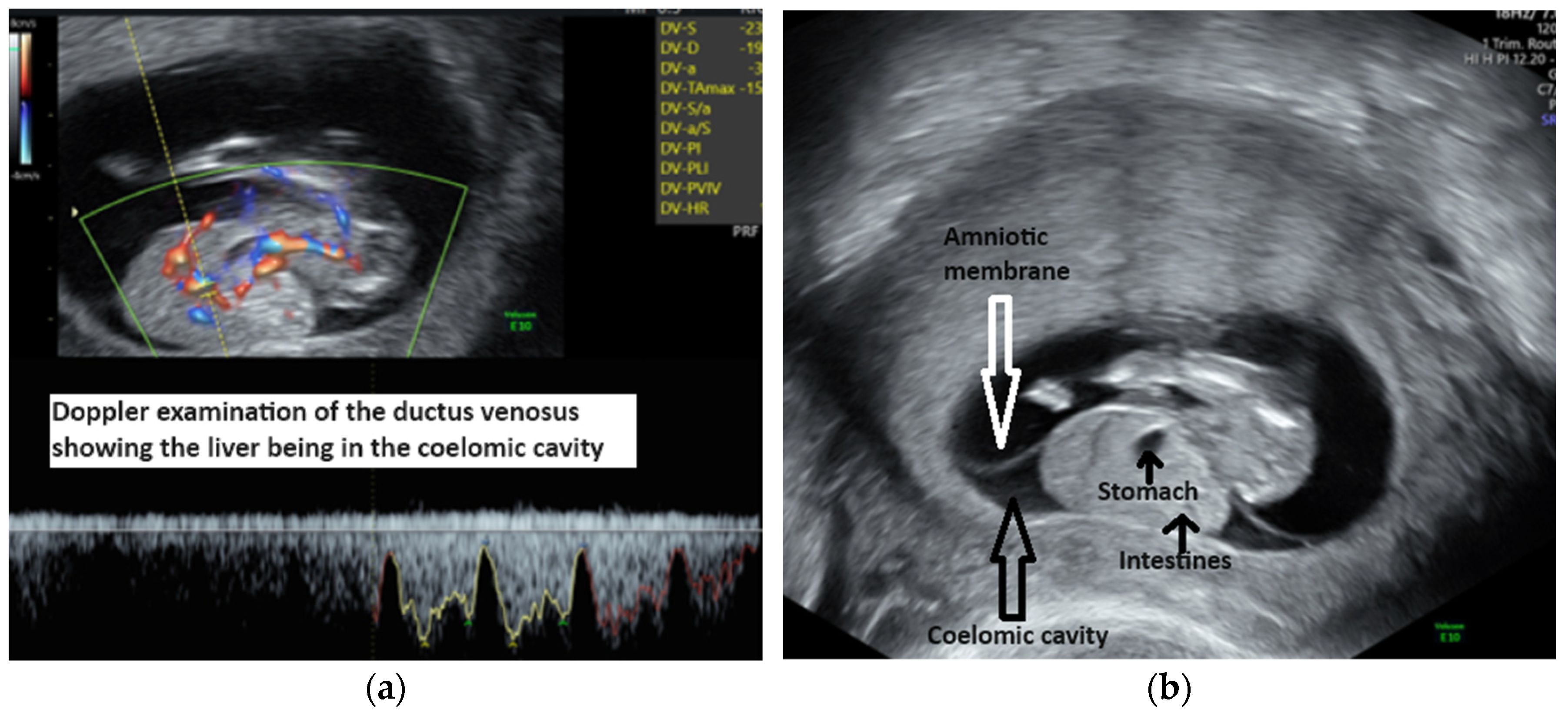 Diagnostics 14 00518 g002