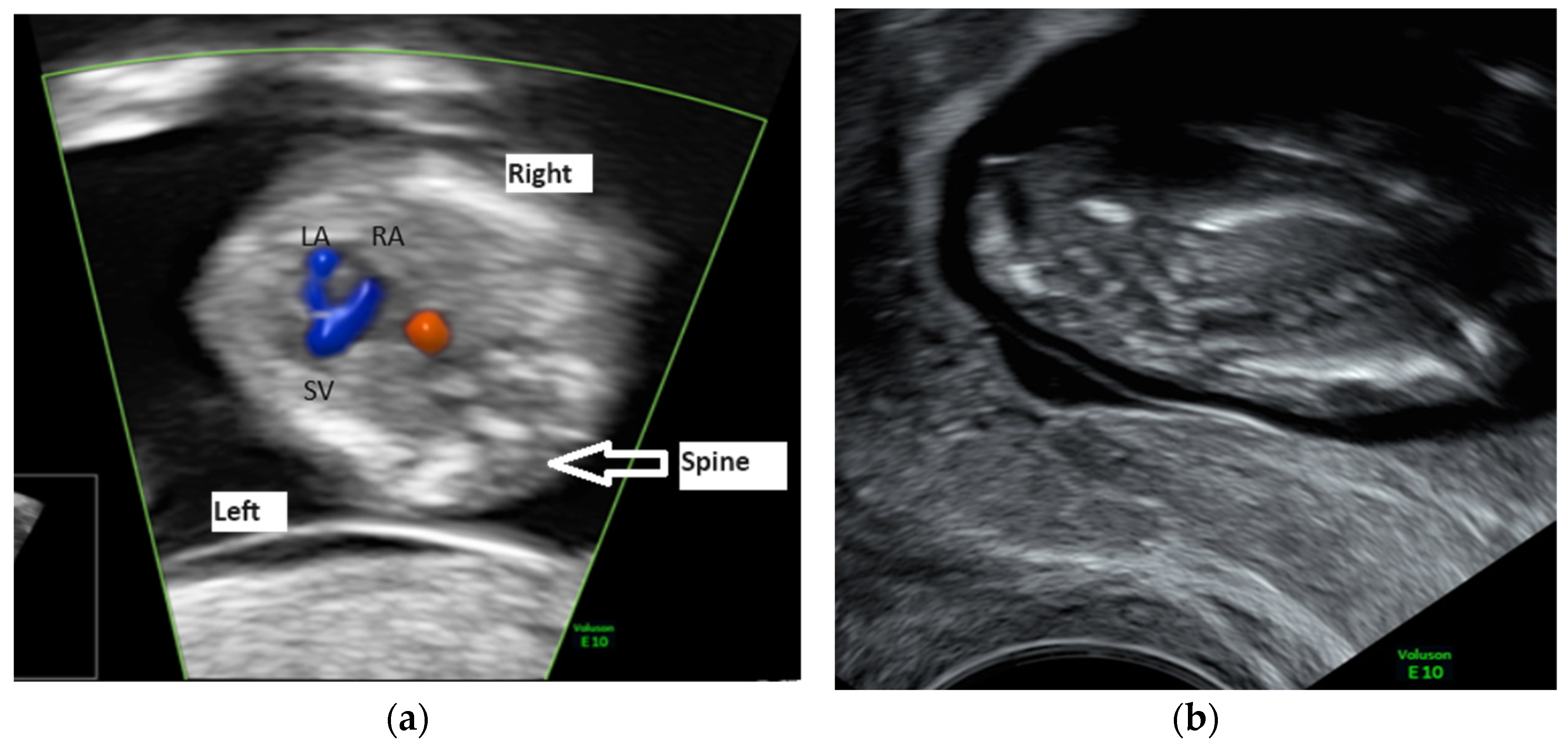 Diagnostics 14 00518 g003