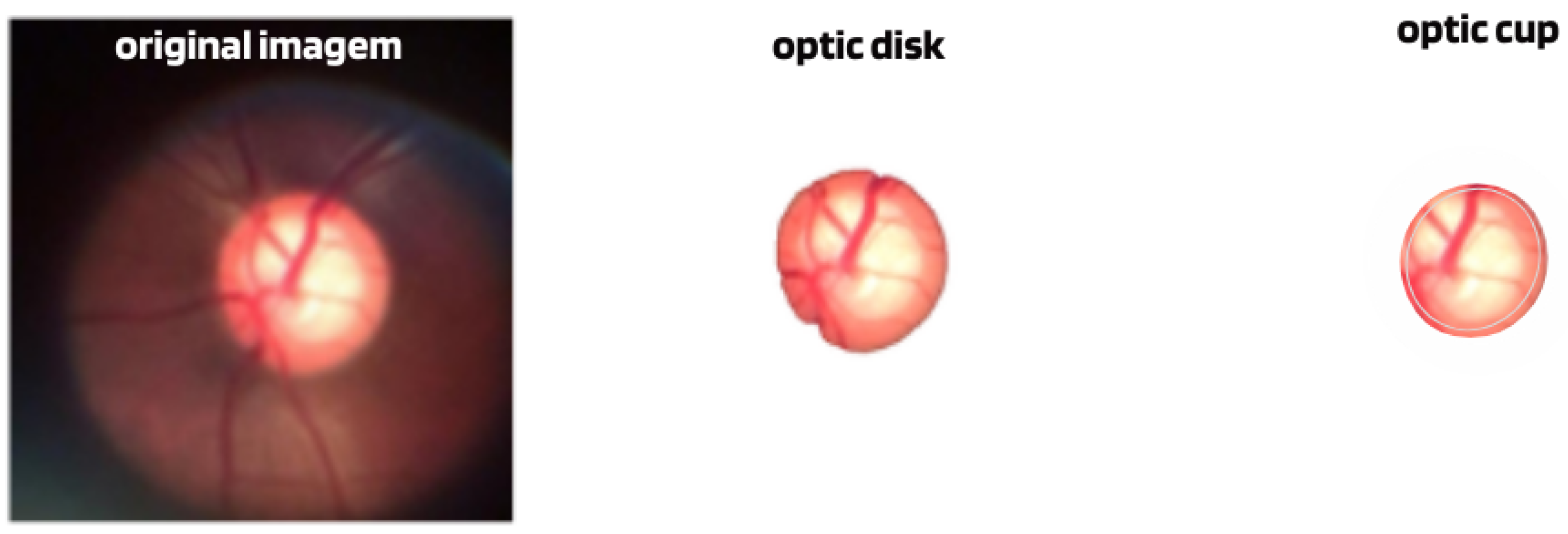 Diagnostics 14 00530 g004