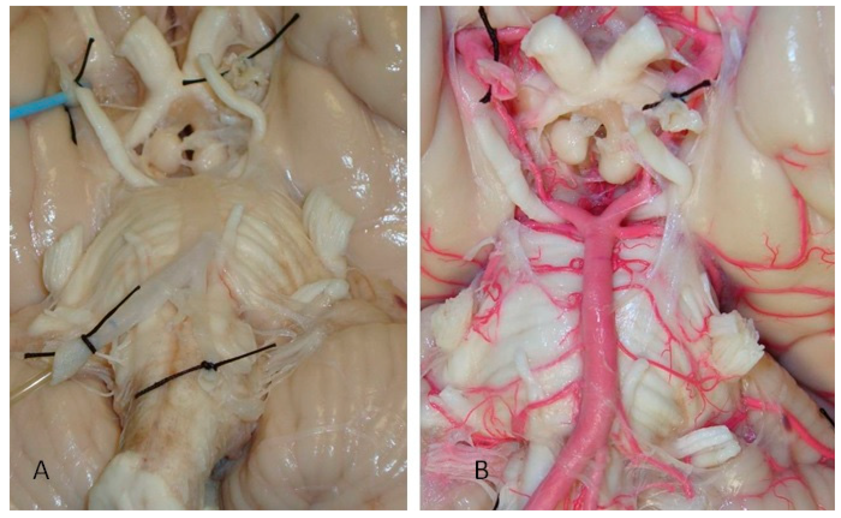 Diagnostics 14 00534 g002