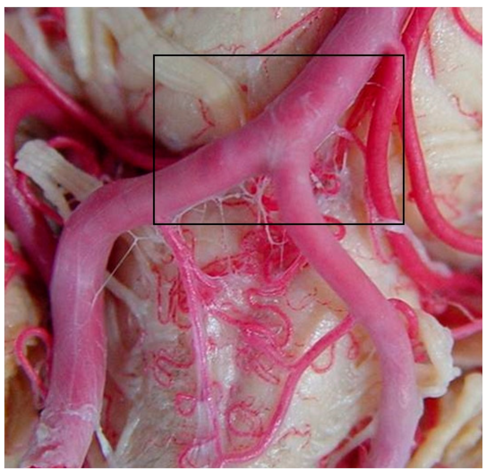 Diagnostics 14 00534 g003