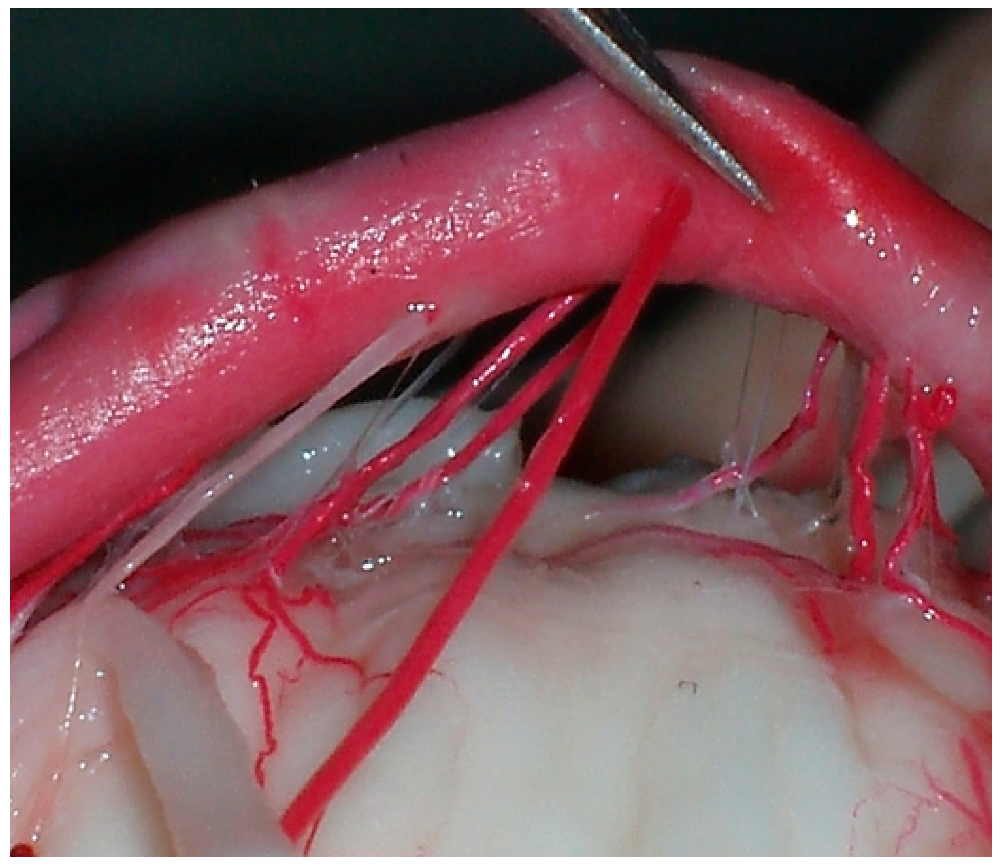 Diagnostics 14 00534 g004