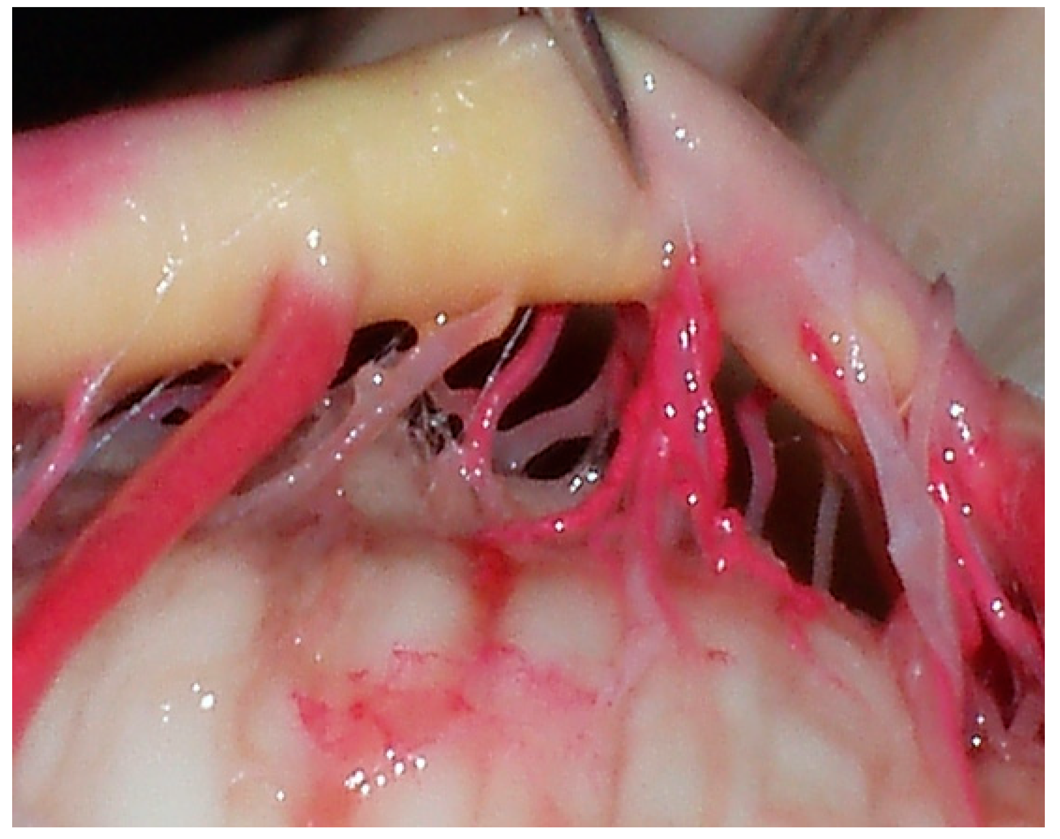 Diagnostics 14 00534 g006