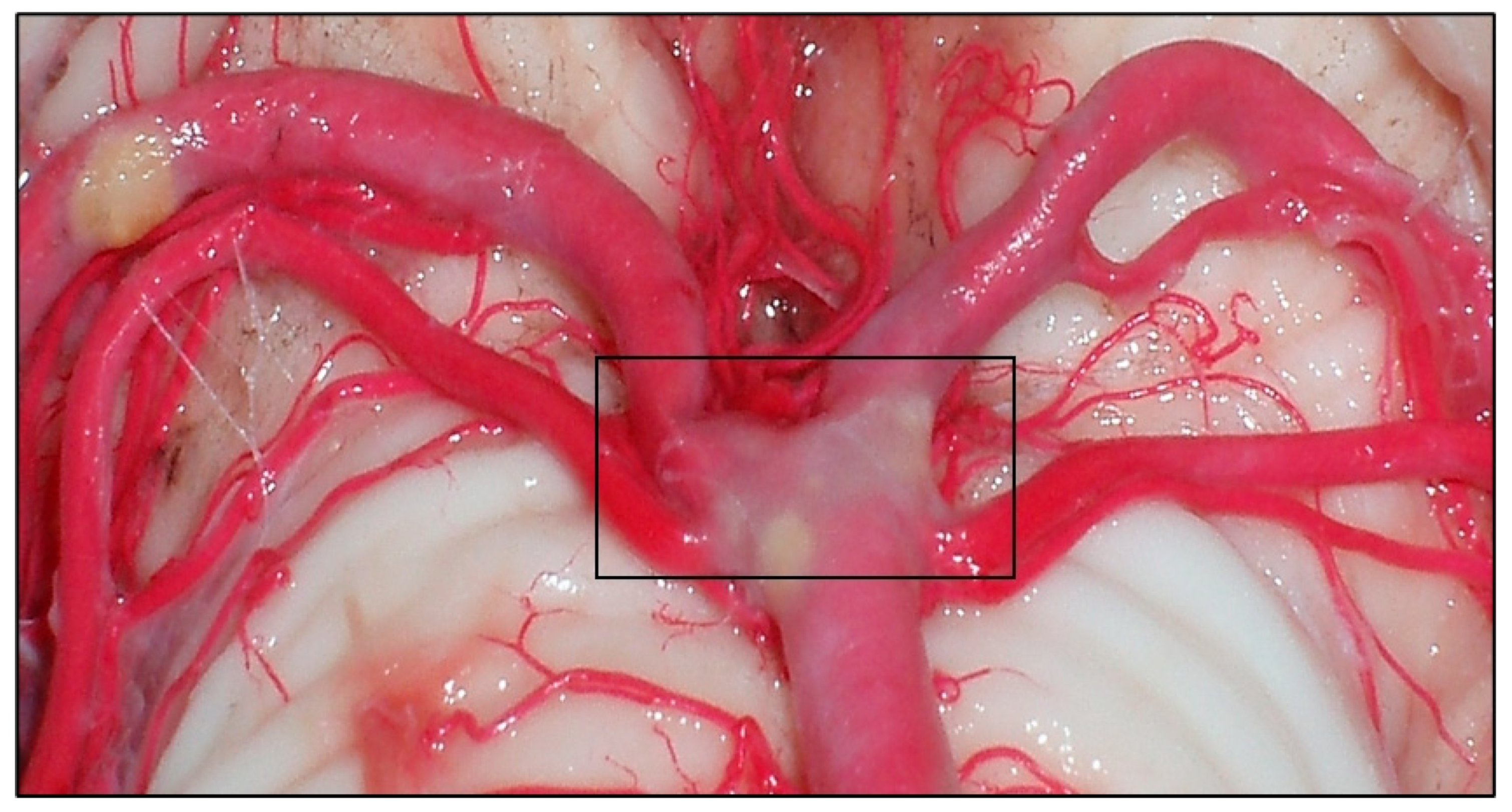 Diagnostics 14 00534 g007