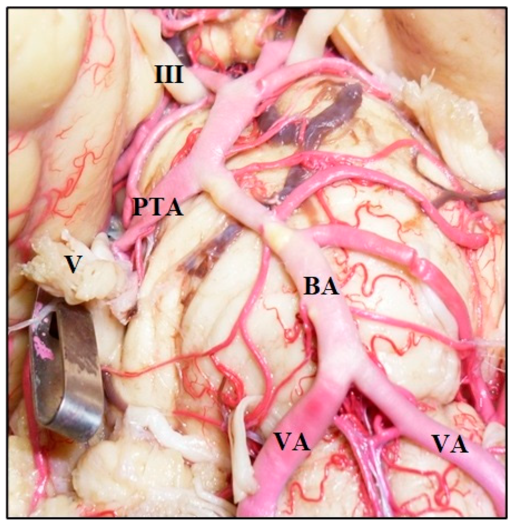 Diagnostics 14 00534 g009