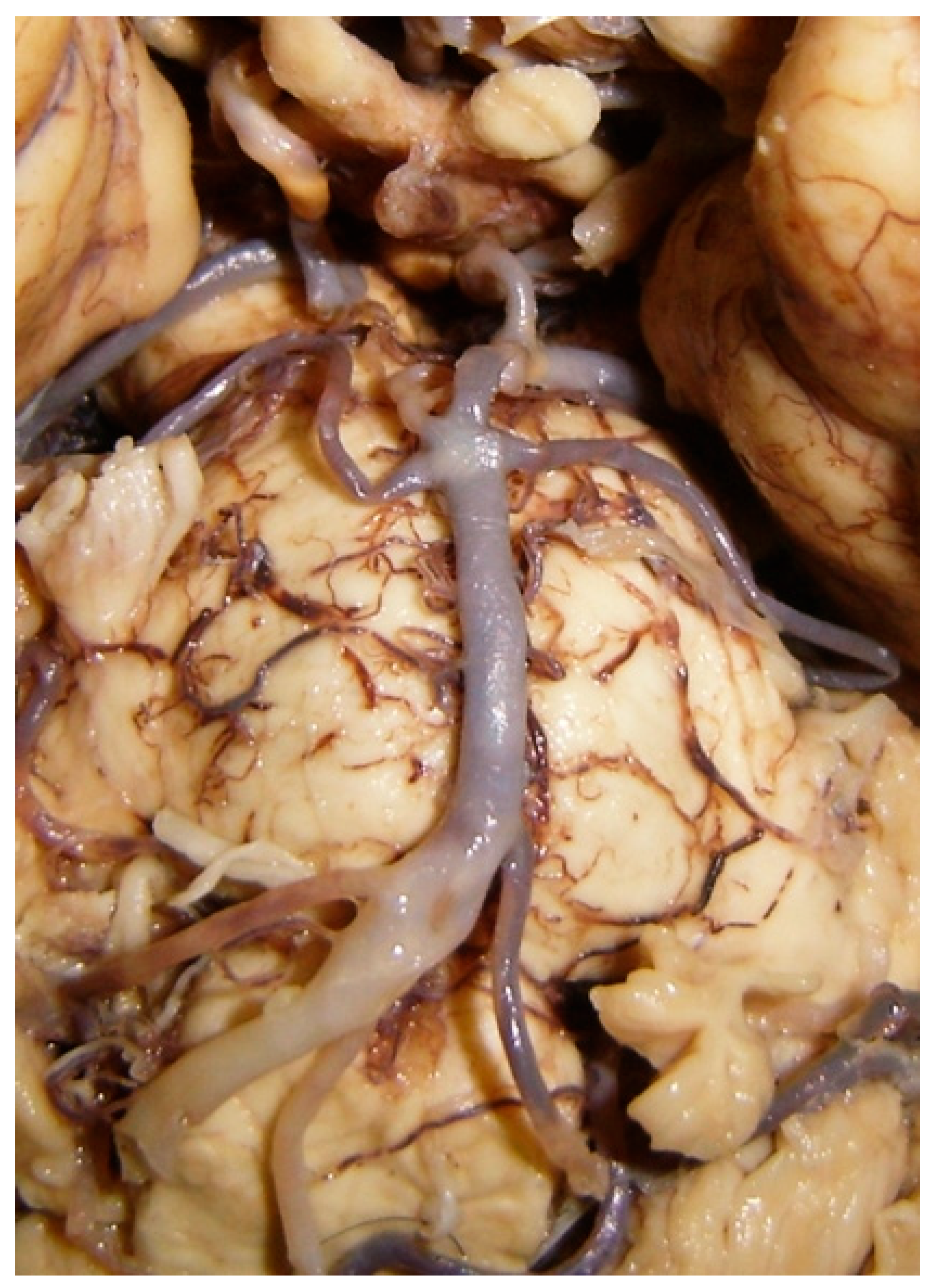 Diagnostics 14 00534 g010