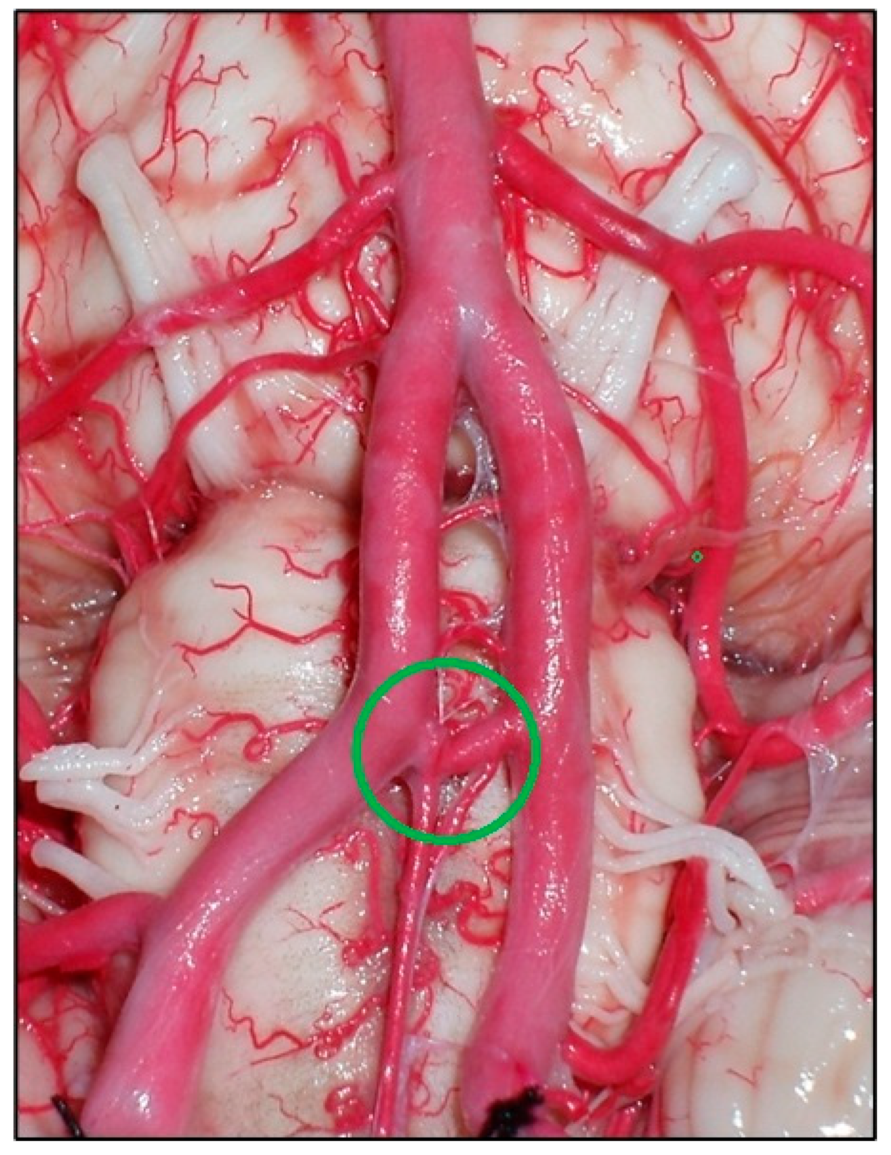 Diagnostics 14 00534 g011