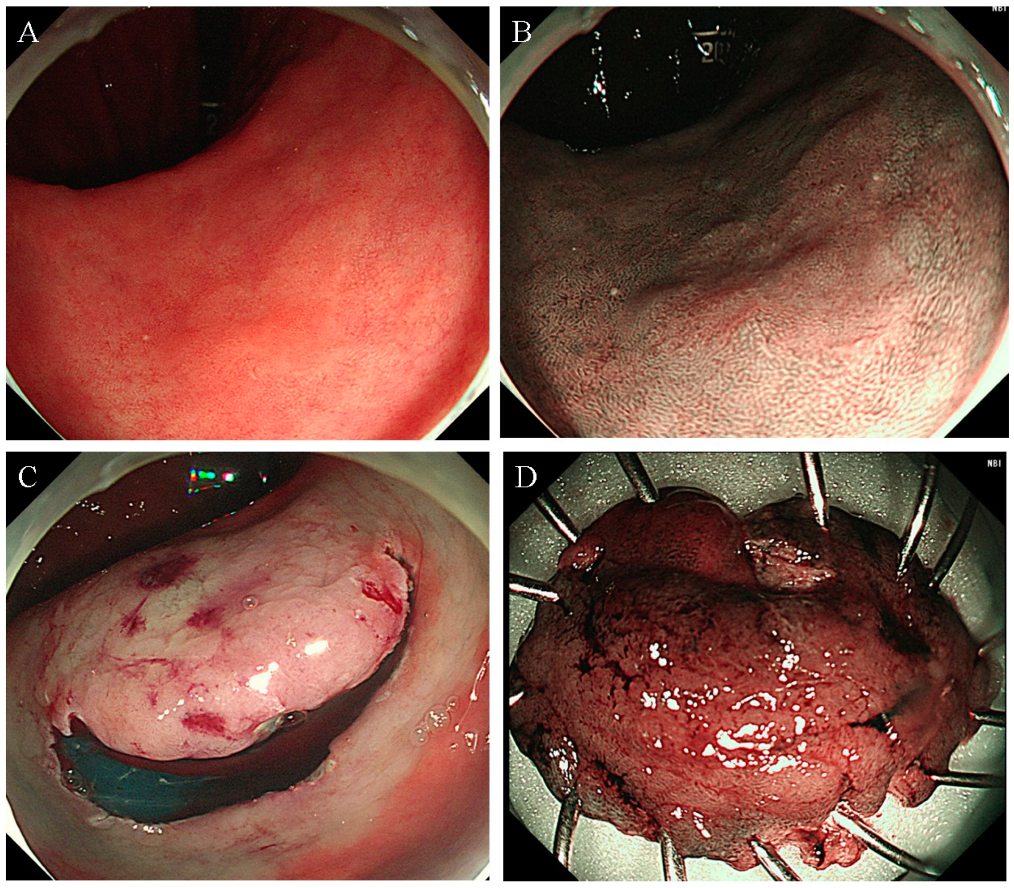 Diagnostics 14 00536 g002 Diagnostics 14 00536 g002