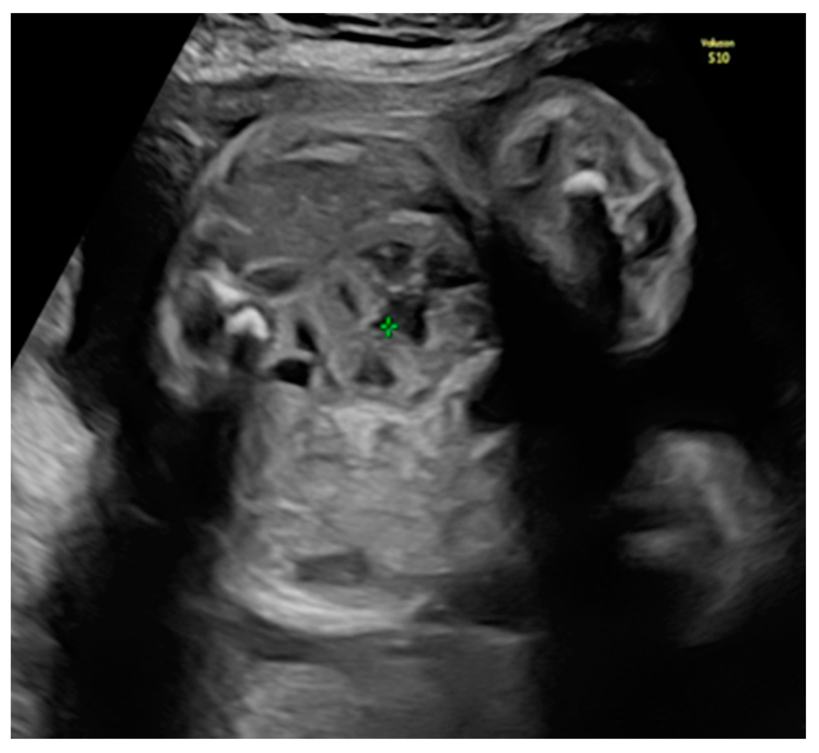 Diagnostics 14 00539 g001