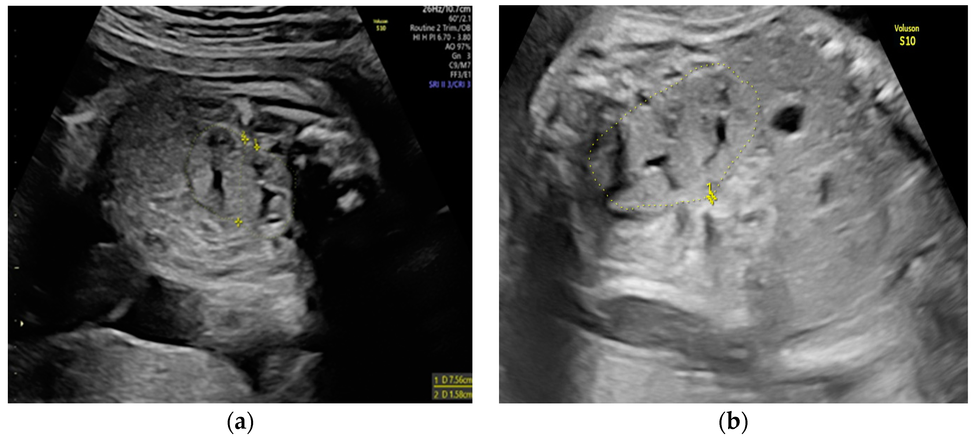 Diagnostics 14 00539 g002