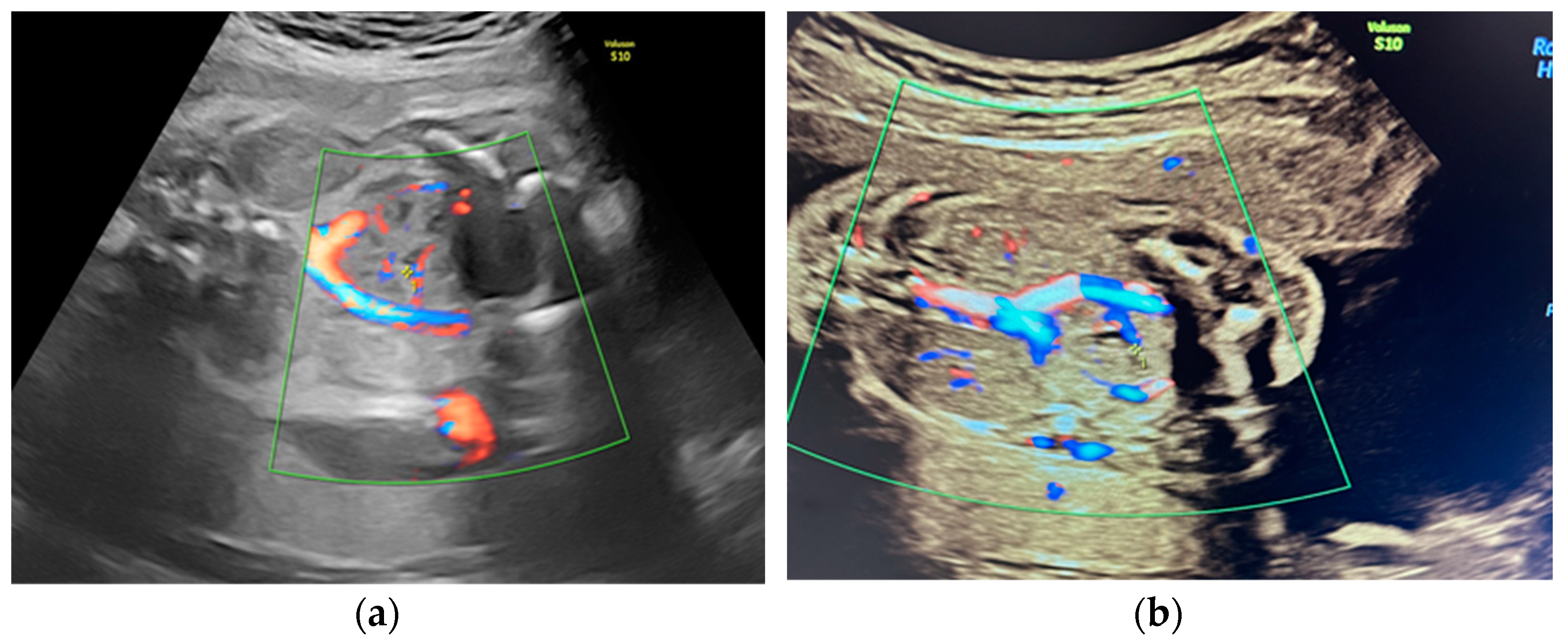 Diagnostics 14 00539 g003