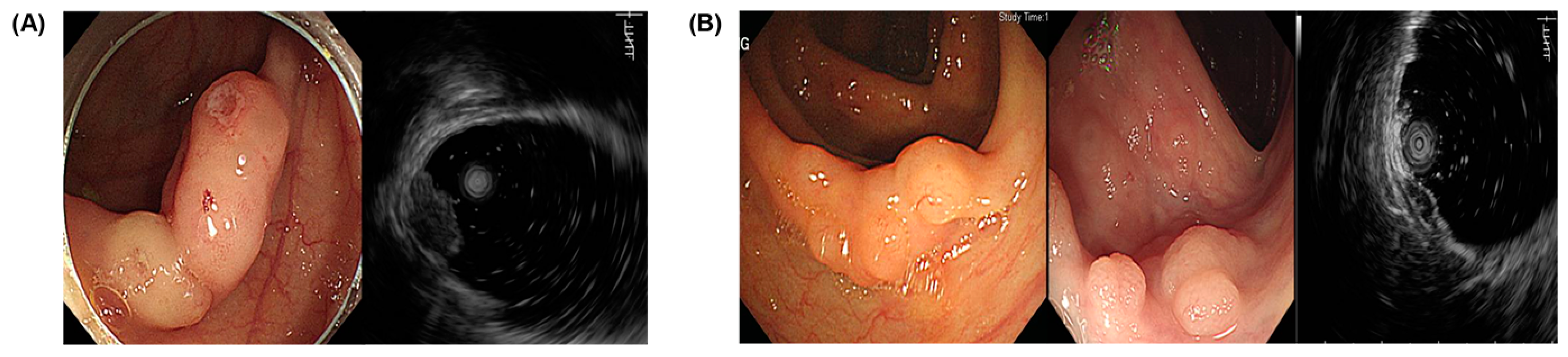 Diagnostics 14 00551 g001