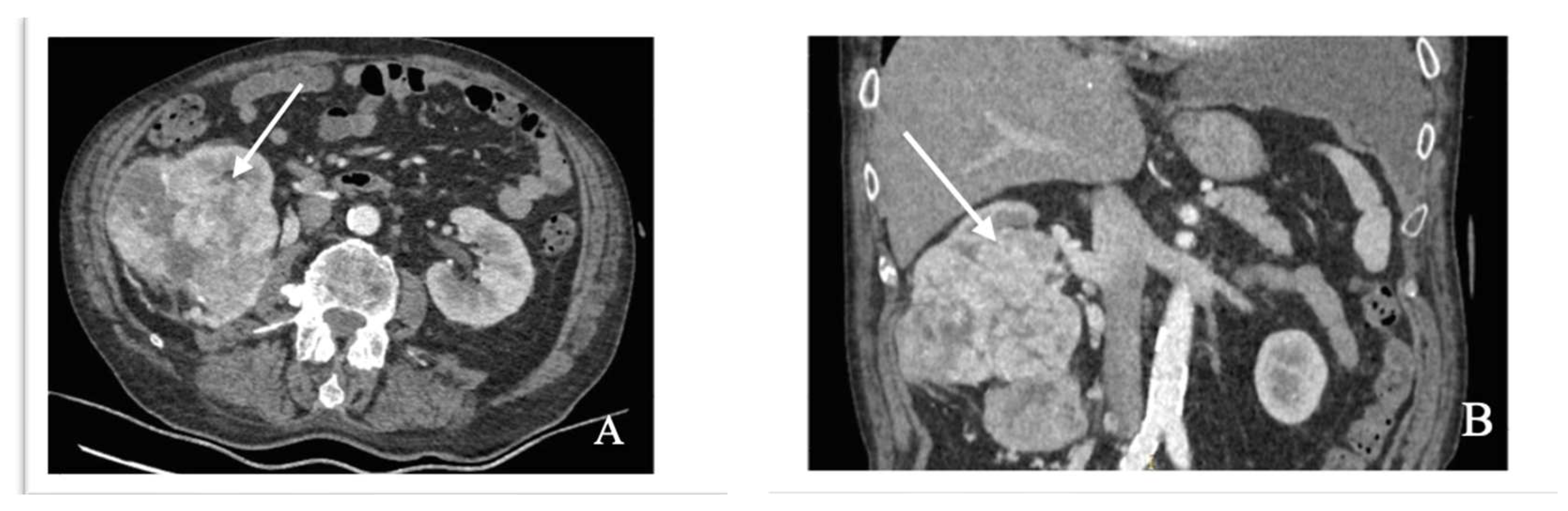 Diagnostics 14 00553 g005 Diagnostics 14 00553 g005