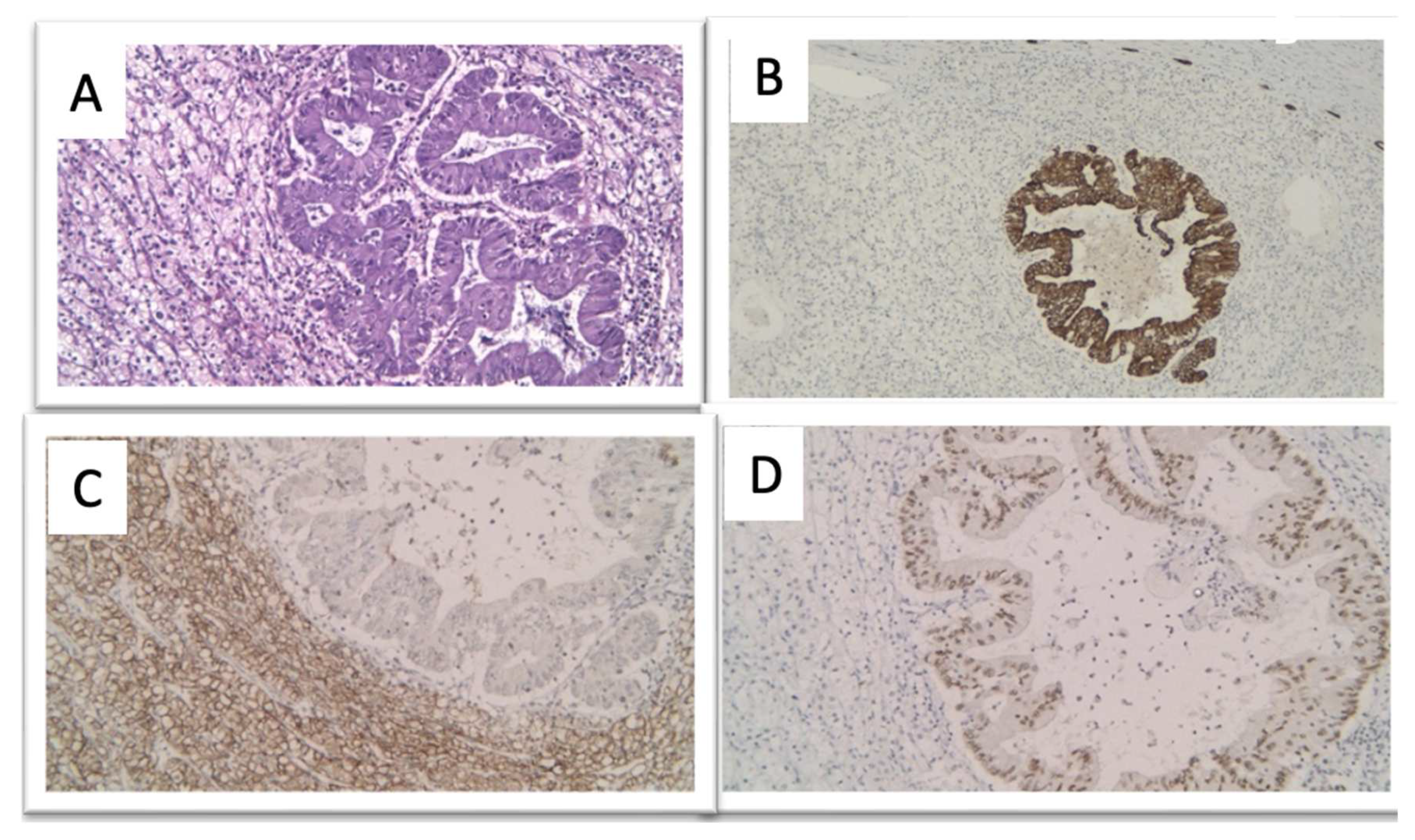 Diagnostics 14 00553 g006 Diagnostics 14 00553 g006