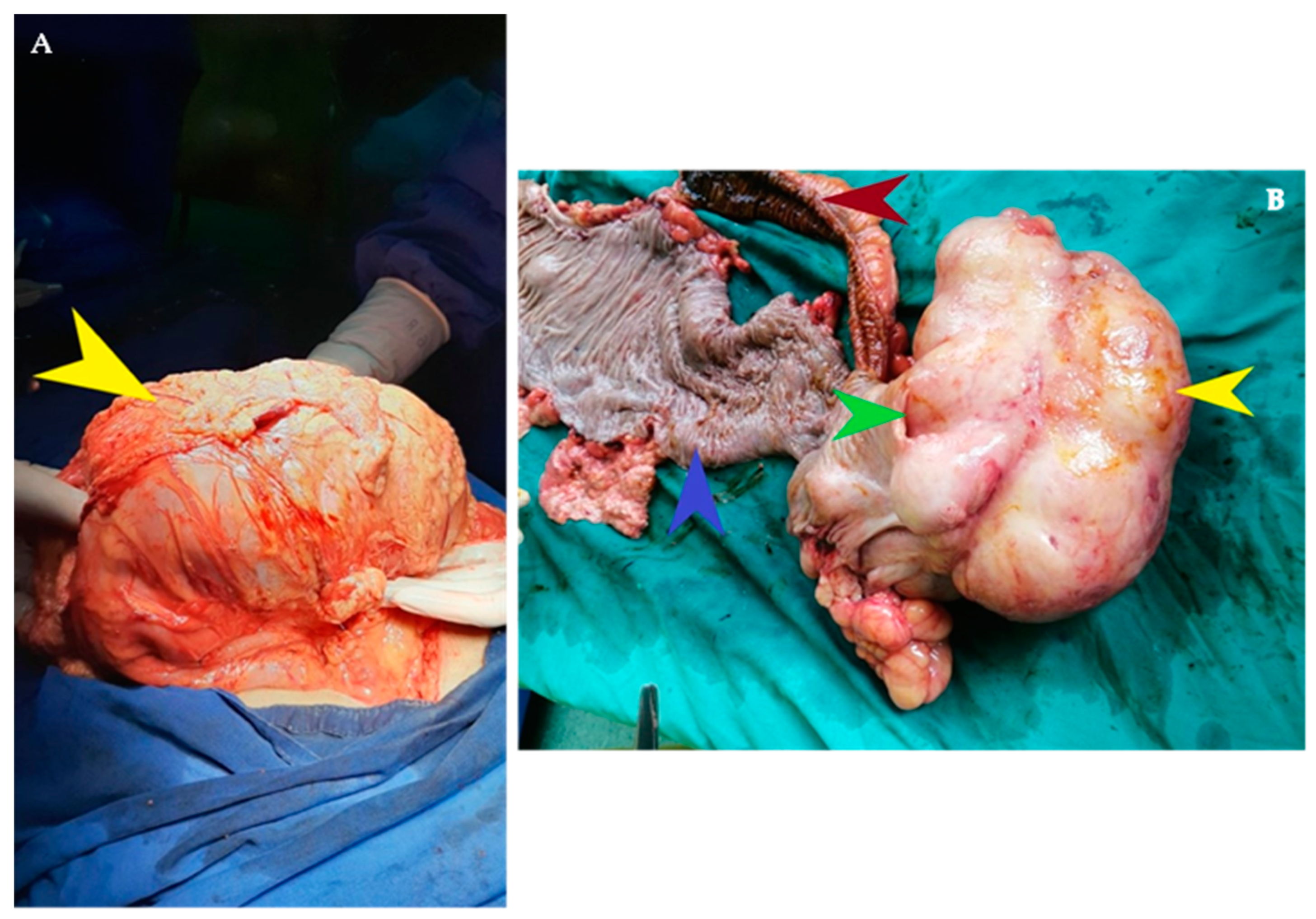 Diagnostics 14 00562 g002