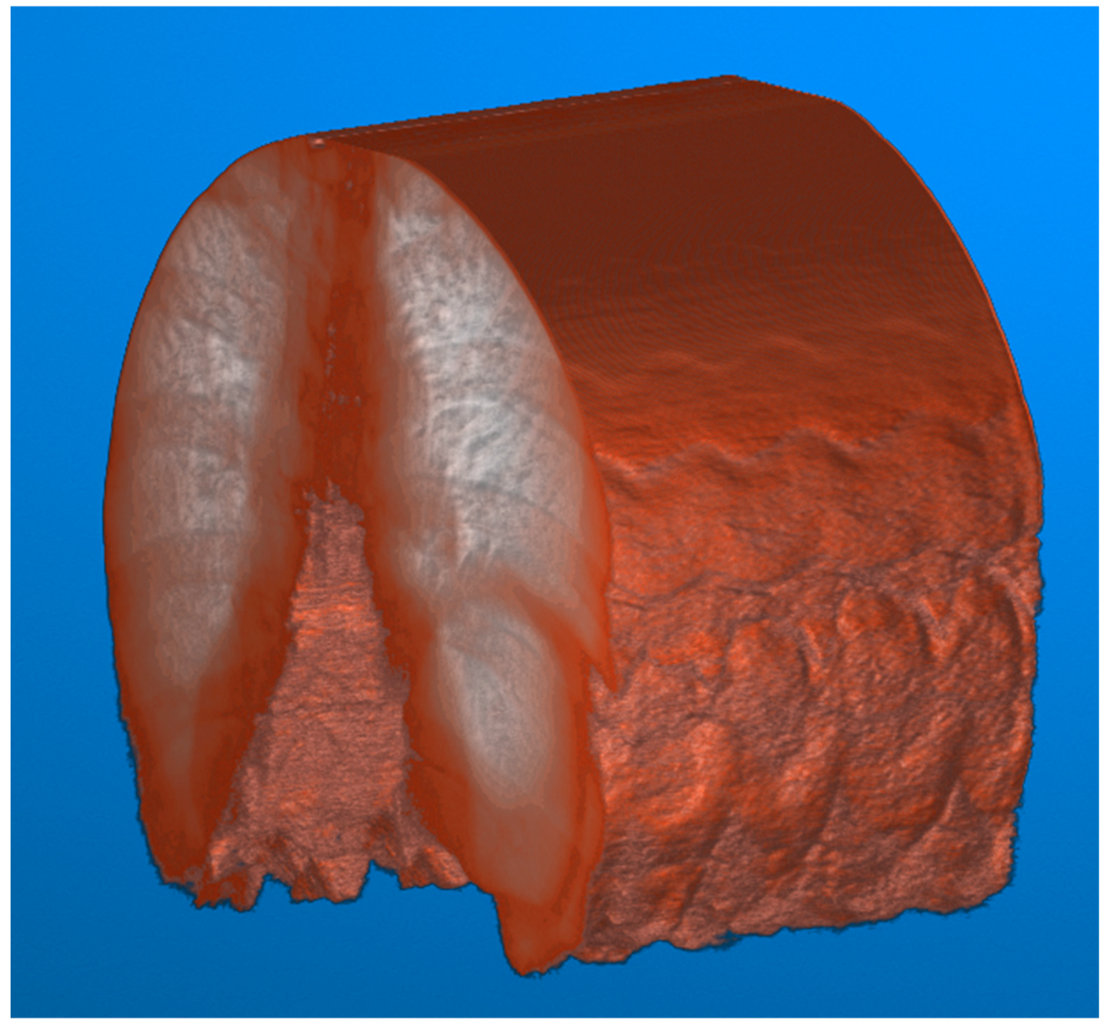 Diagnostics 14 00567 g008