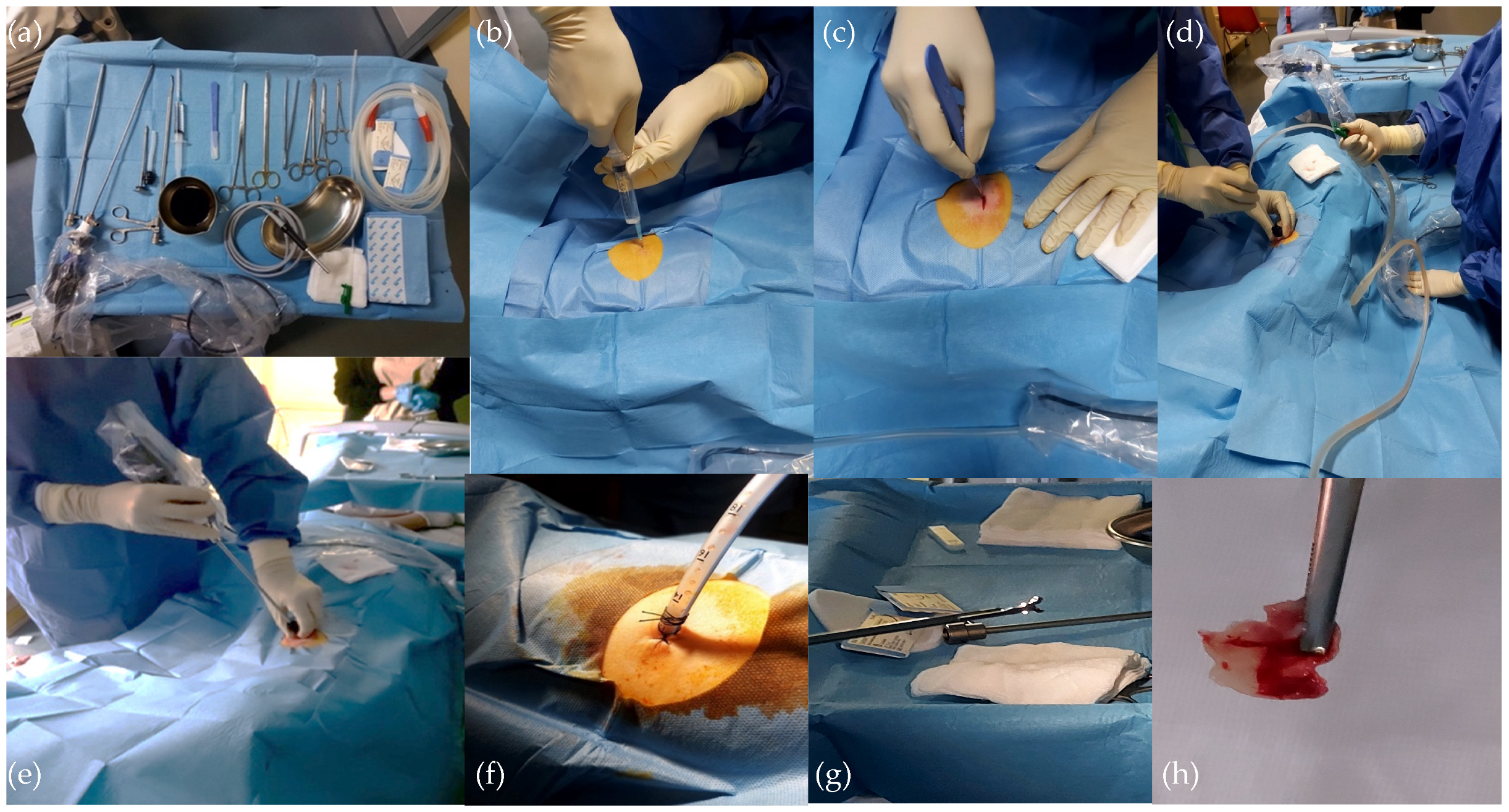 Diagnostics 14 00569 g001