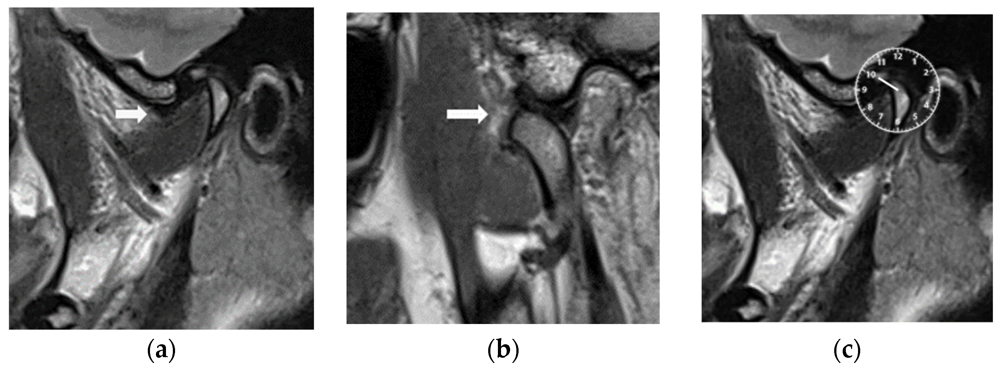 Diagnostics 14 00572 g003