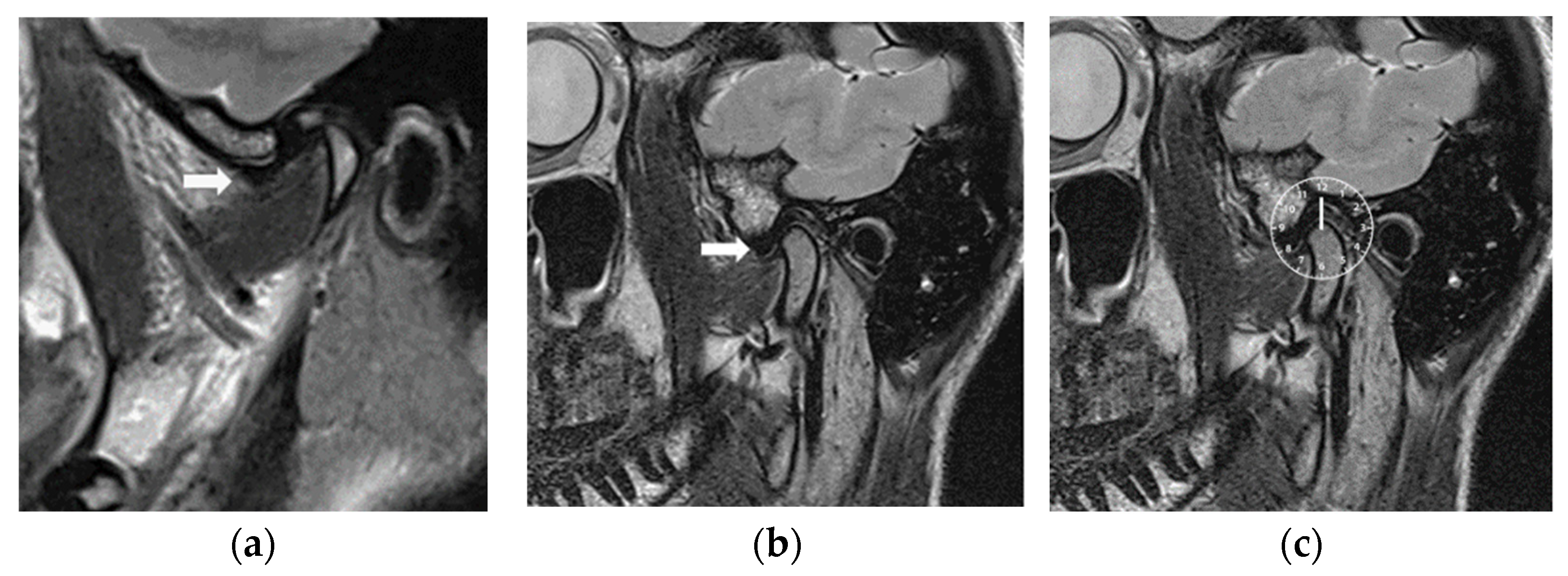 Diagnostics 14 00572 g004
