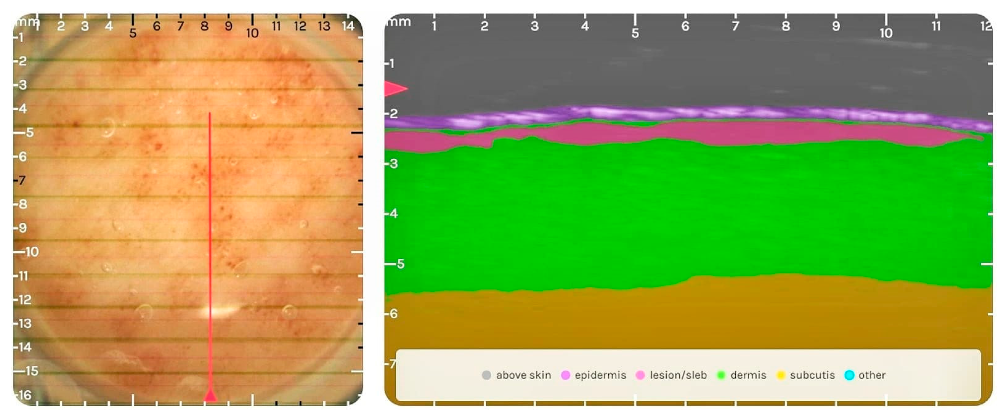 Diagnostics 14 00575 g004