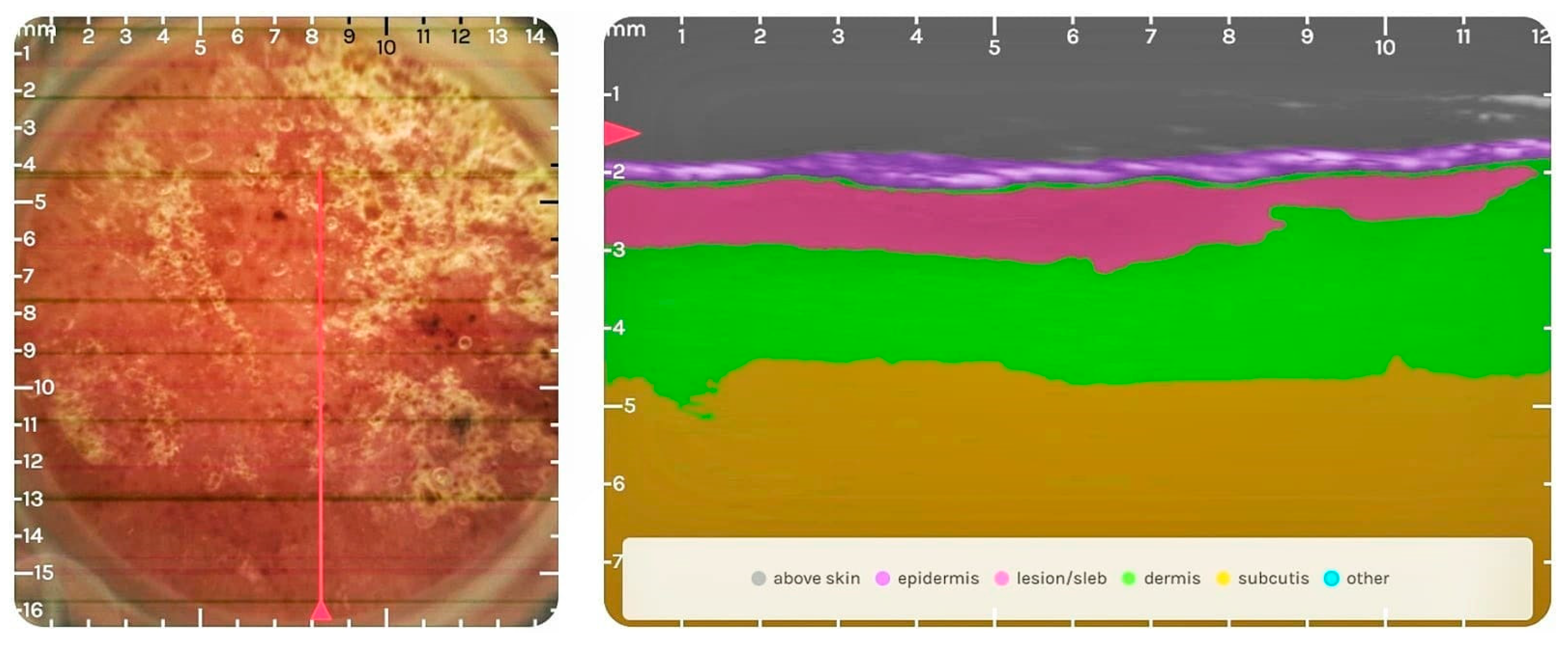 Diagnostics 14 00575 g005