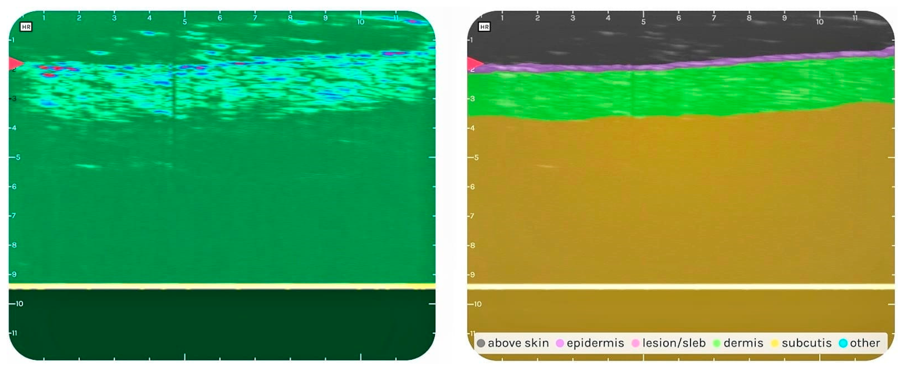 Diagnostics 14 00575 g006